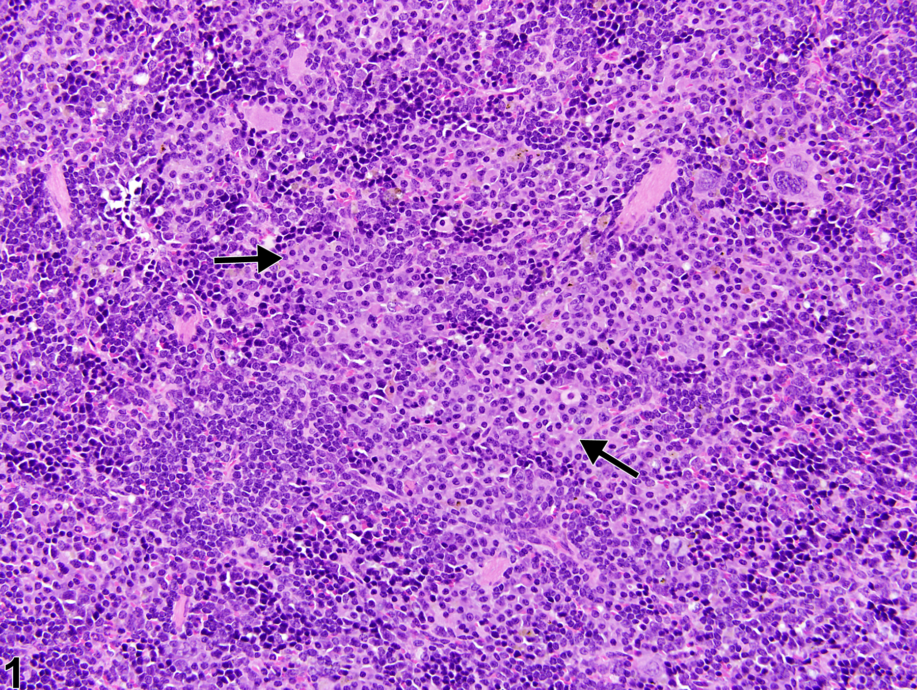 Image of hyperplasia, plasma cell in the spleen from a female B6C3F1/N mouse in a chronic study