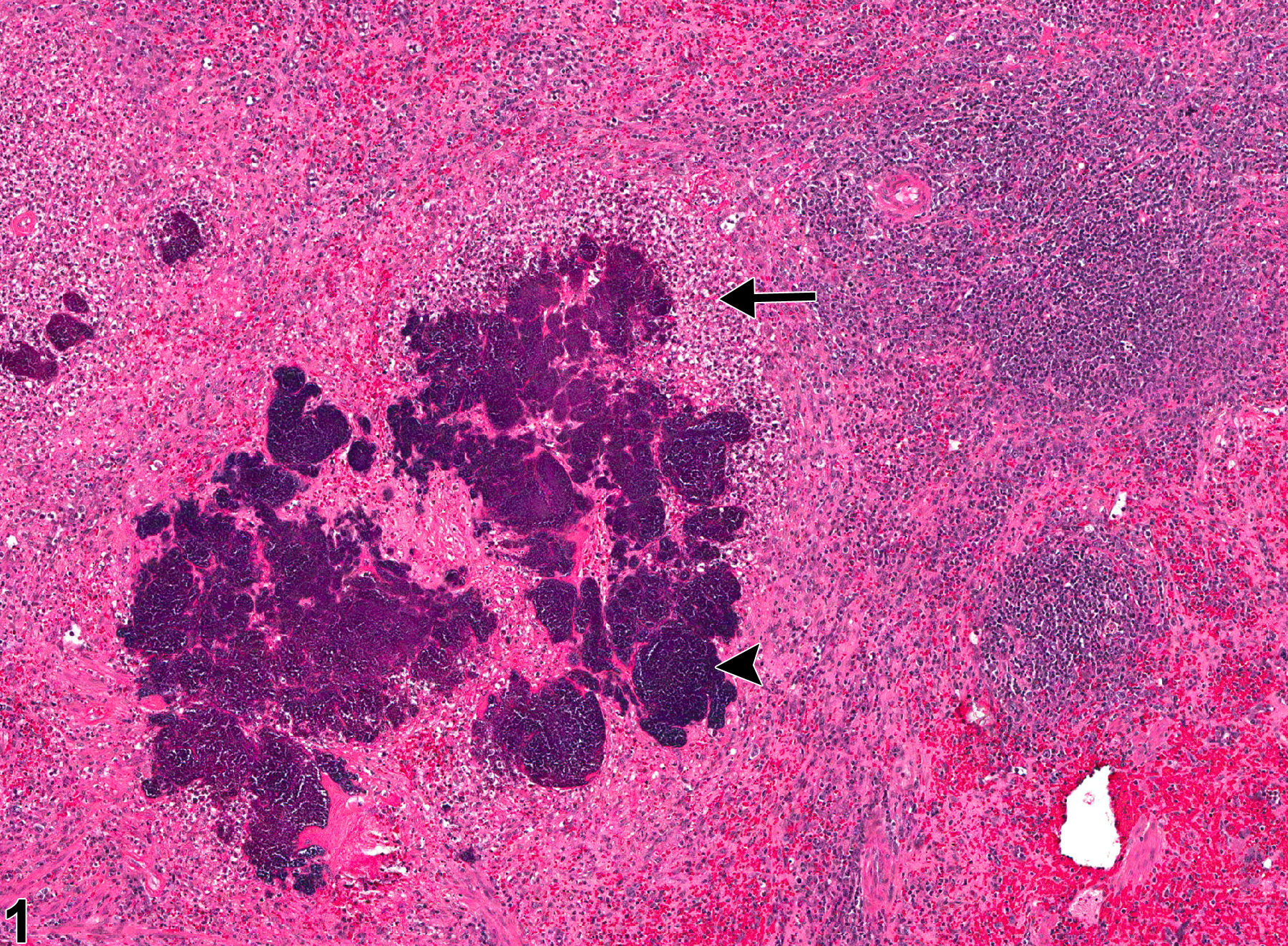 Image of inflammation in the spleen from a male F344/N rat in a chronic study