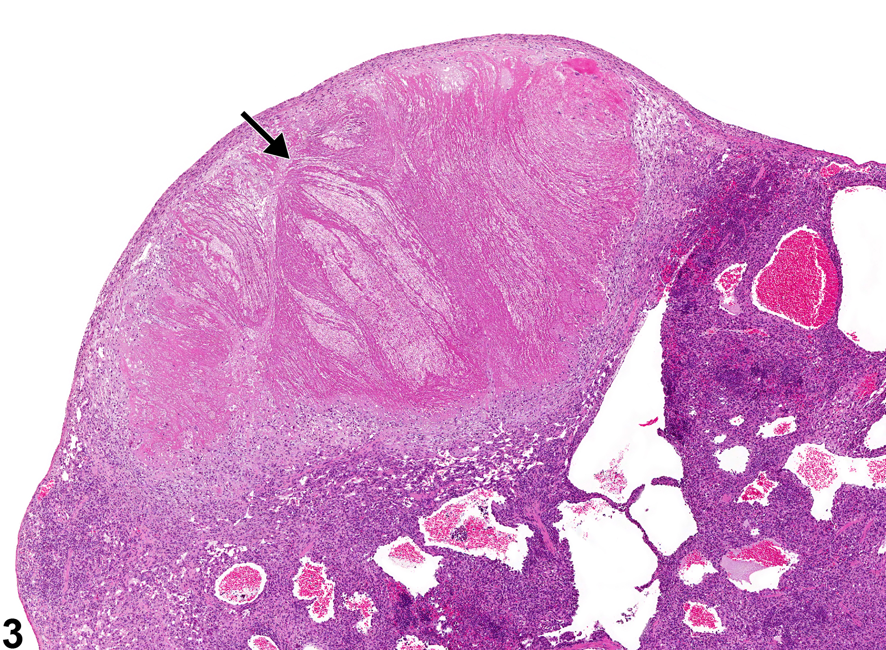 Image of necrosis in the spleen from a male B6C3F1/N mouse in a chronic study