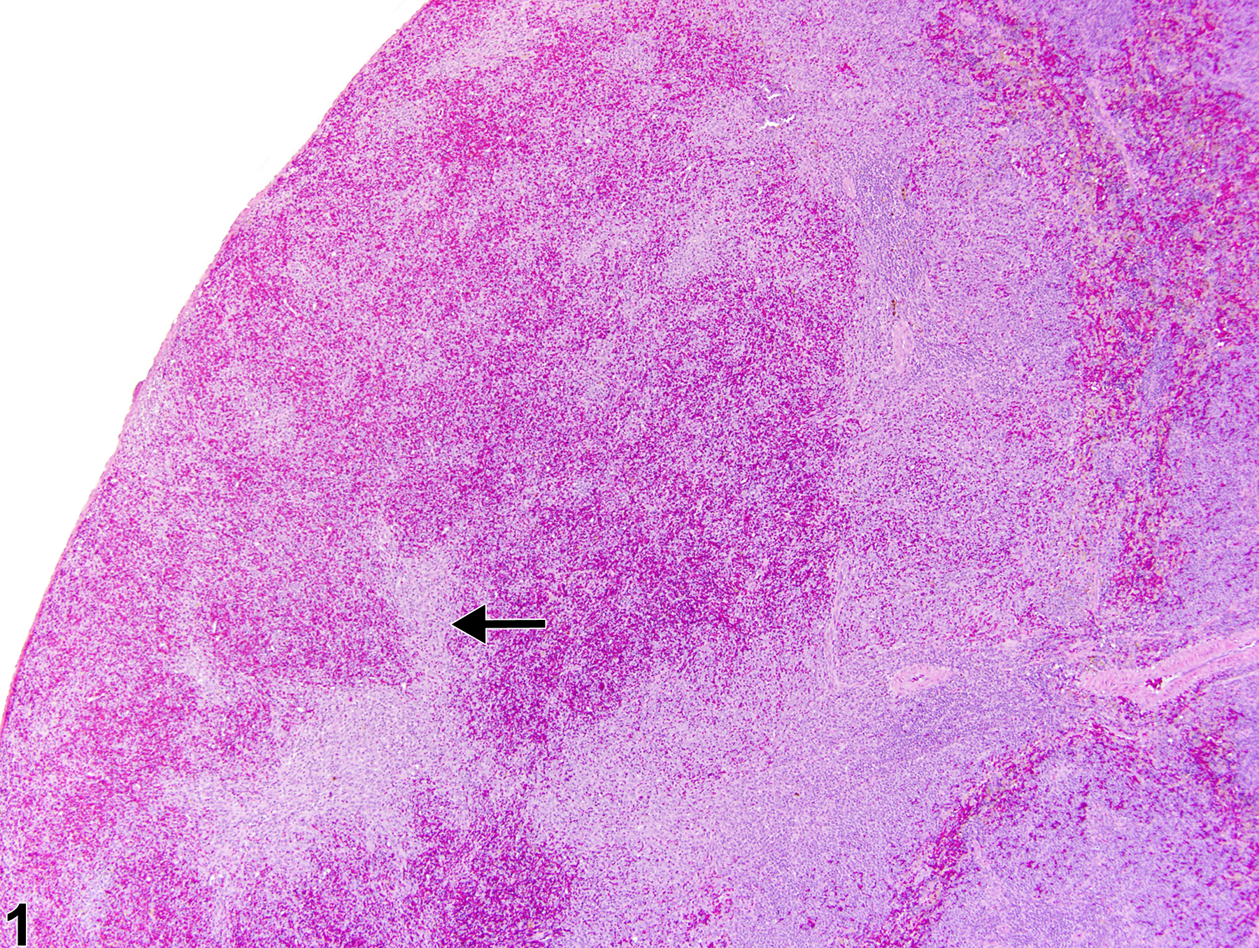 Image of hyperplasia, stromal cell in the spleen from a female F344/N rat in a chronic study