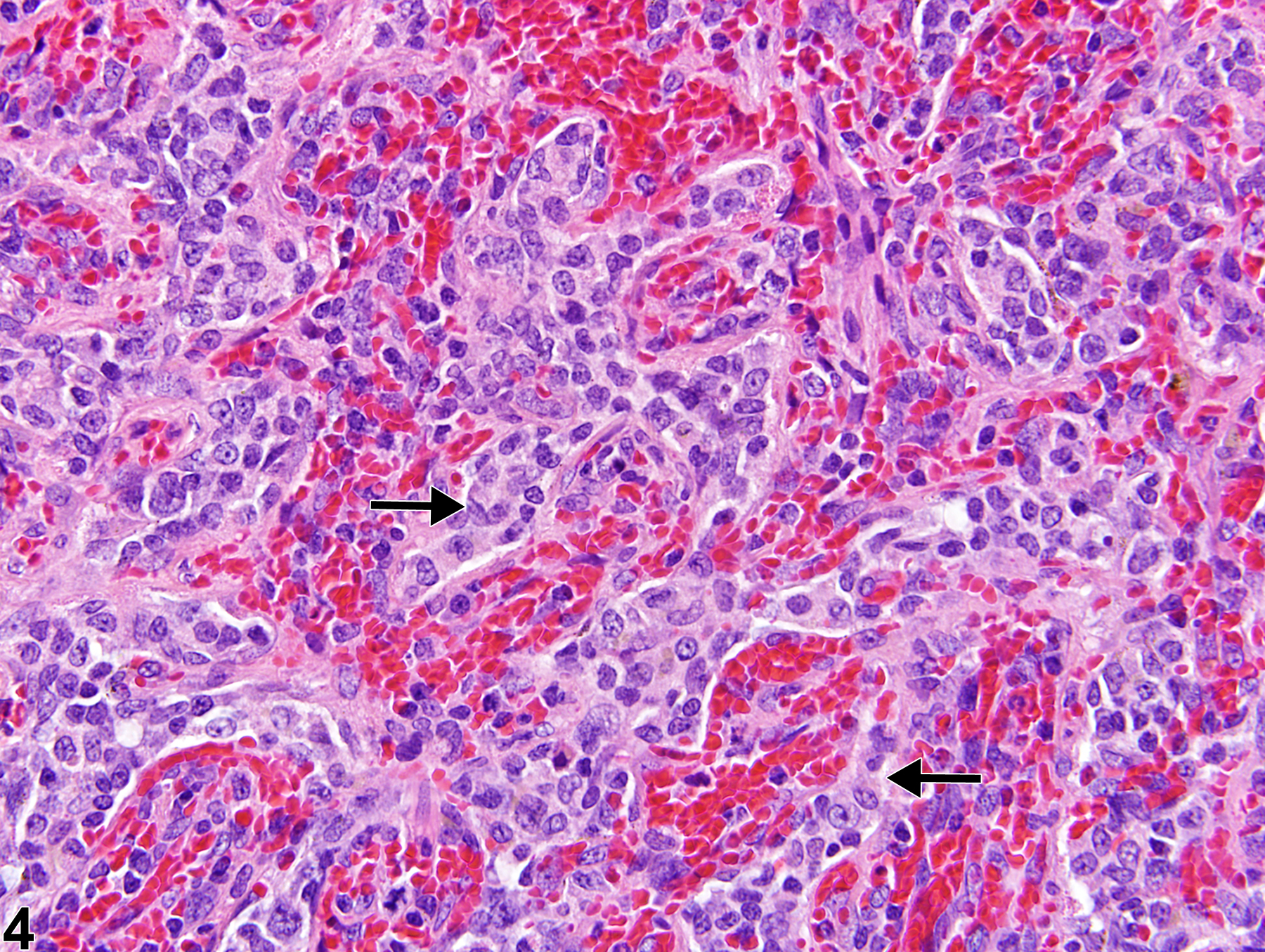 Image of hyperplasia, stromal cell in the spleen from a female F344/N rat in a chronic study