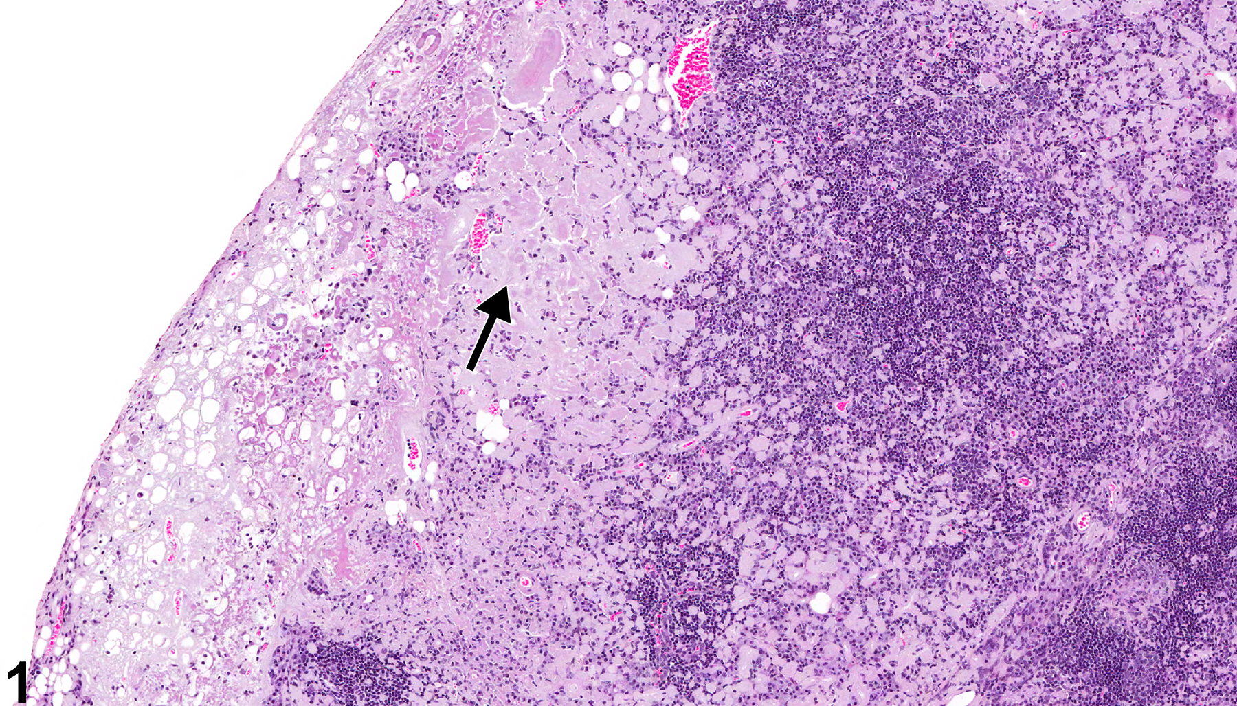 Image of amyloid in the thymus from a female B6C3F1/N mouse in a chronic study