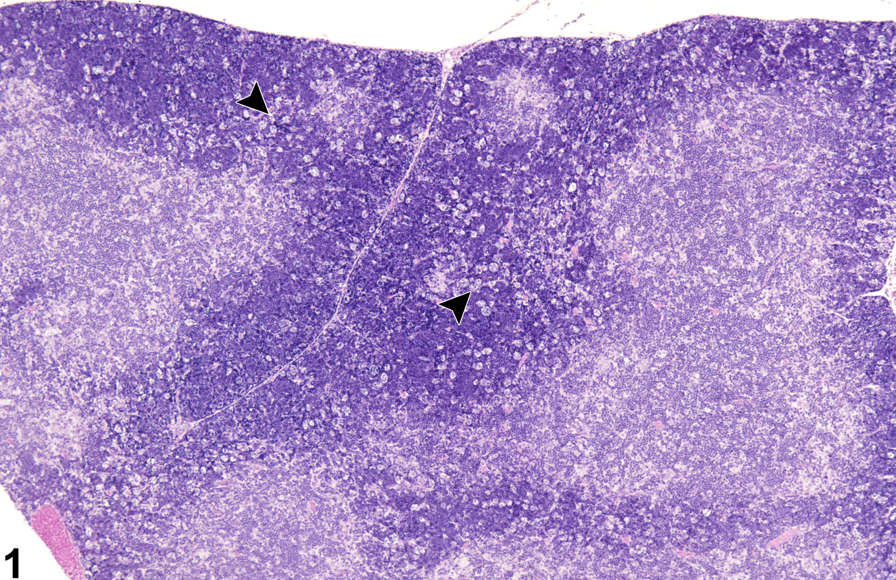 Image of apoptosis, lymphocyte in the thymus from a female B6C3F1/N mouse in a subchronic study