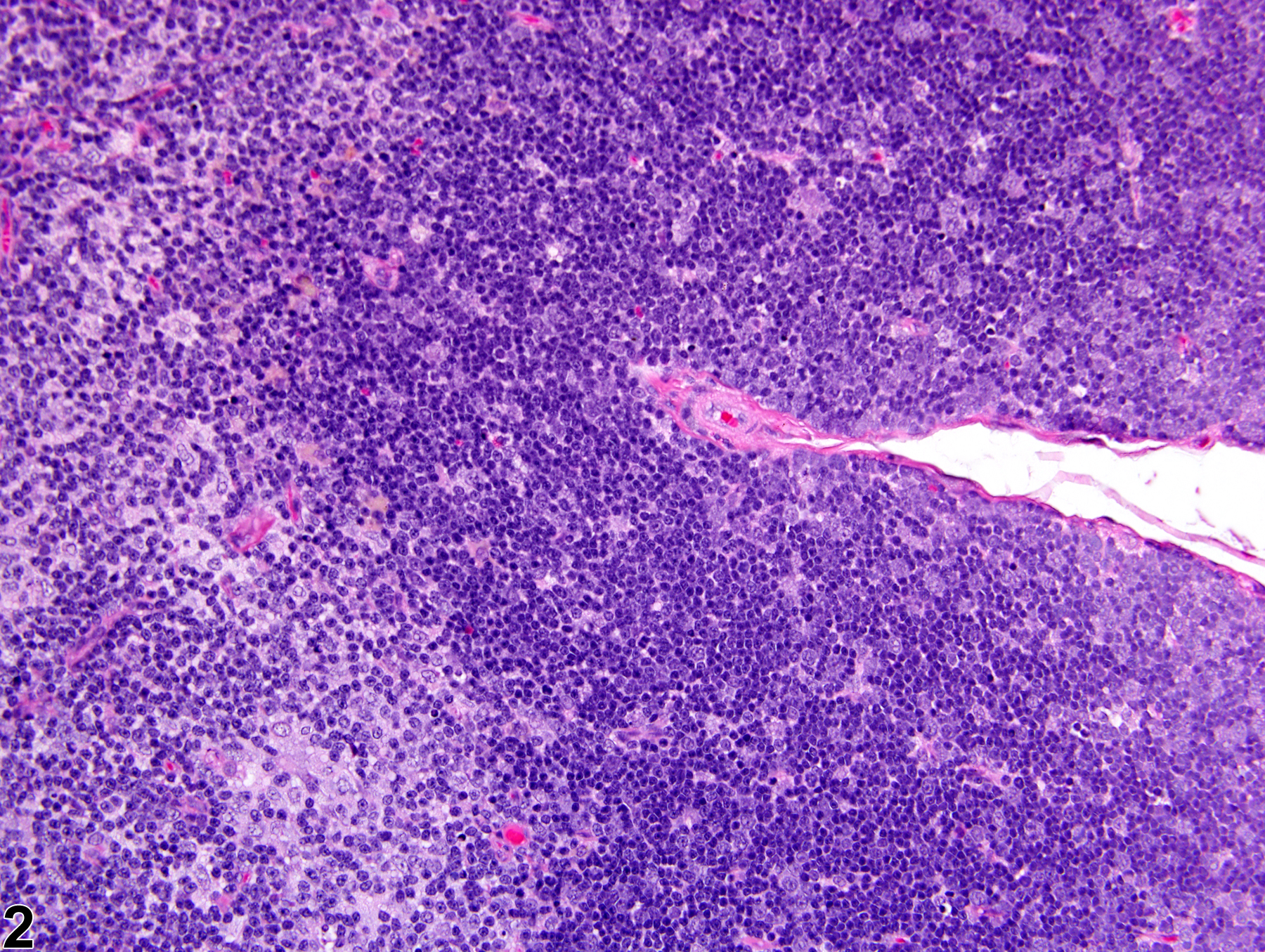 Image of atrophy in the thymus from a male Harlan Sprague-Dawley rat in a subchronic study