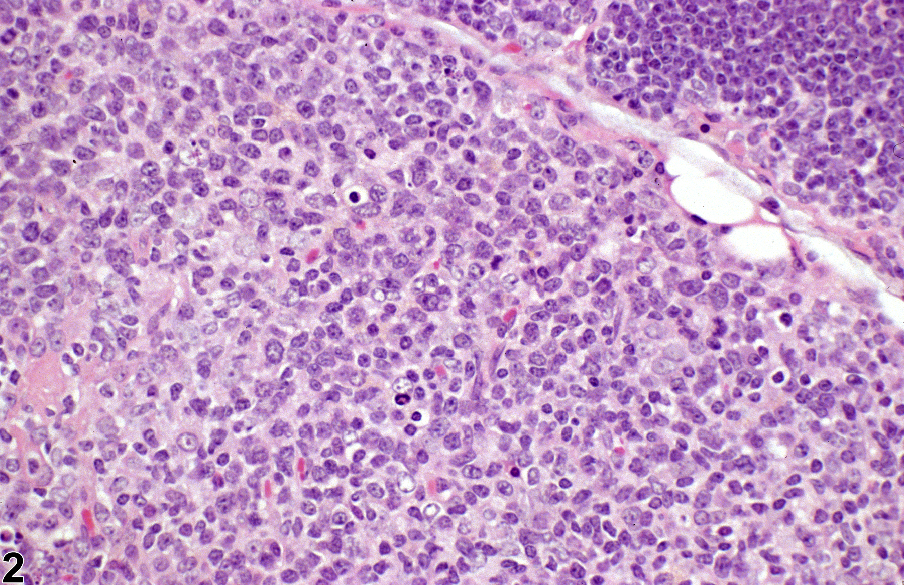 Image of atypical hyperplasia, lymphocyte in the thymus from a female p53+/- (C57Bl/6) mouse in a subchronic study