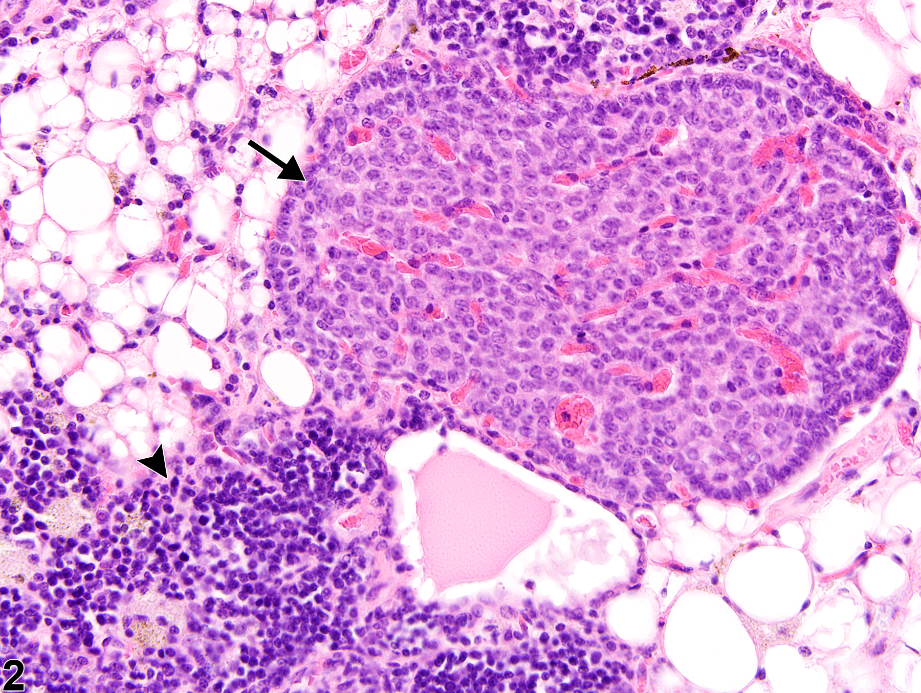 Image of ectopic tissue in the thymus from a female F344/N rat in a chronic study