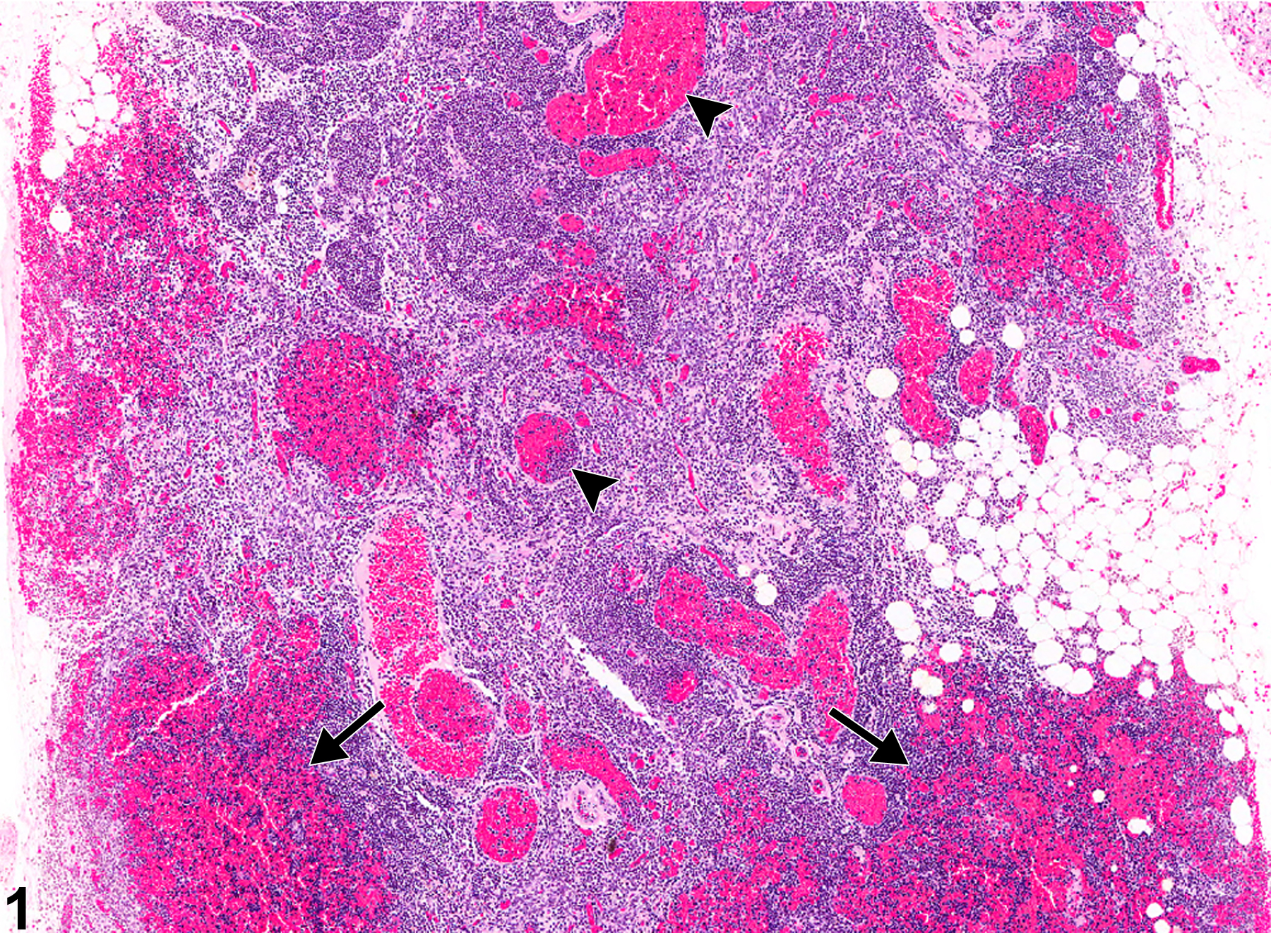 Image of hemorrhage in the thymus from a male F344/N rat in a chronic study