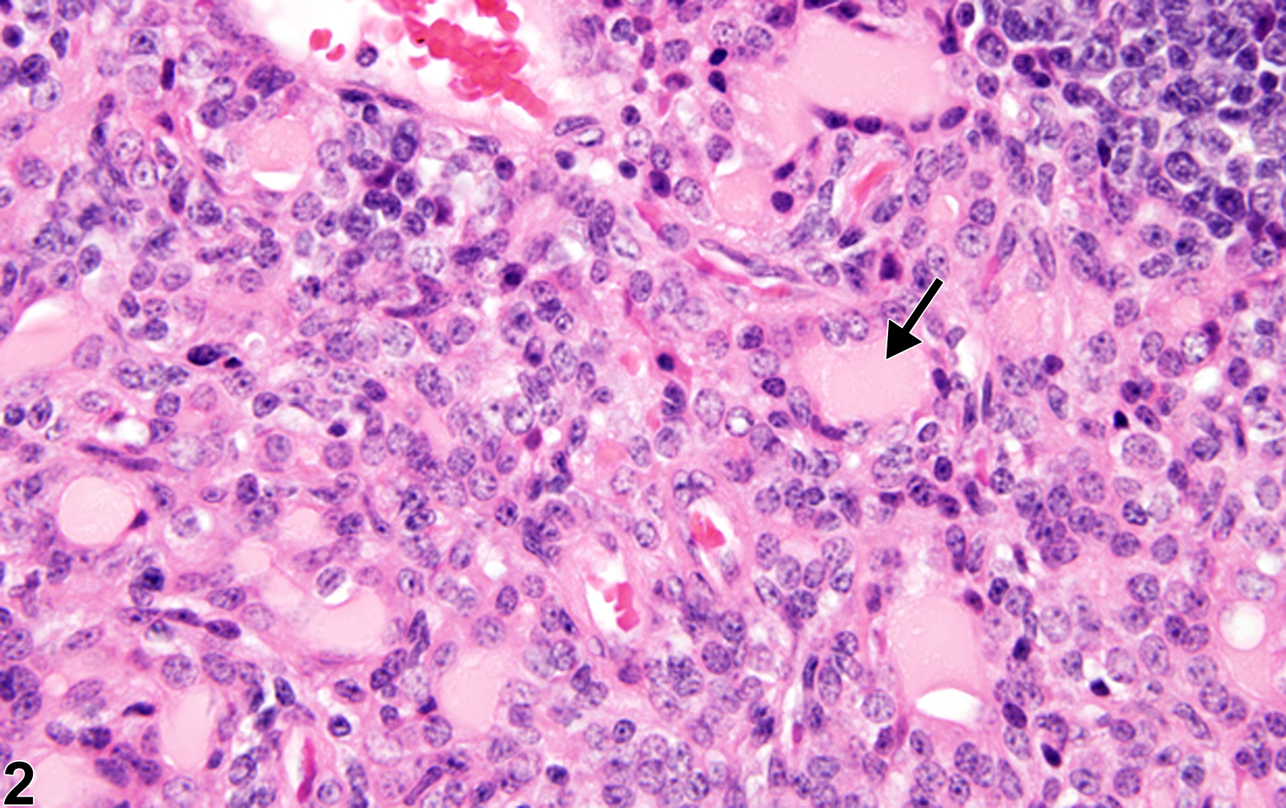 Image of hyperplasia, epithelial in the thymus from a male B6C3F1/N mouse in a chronic study