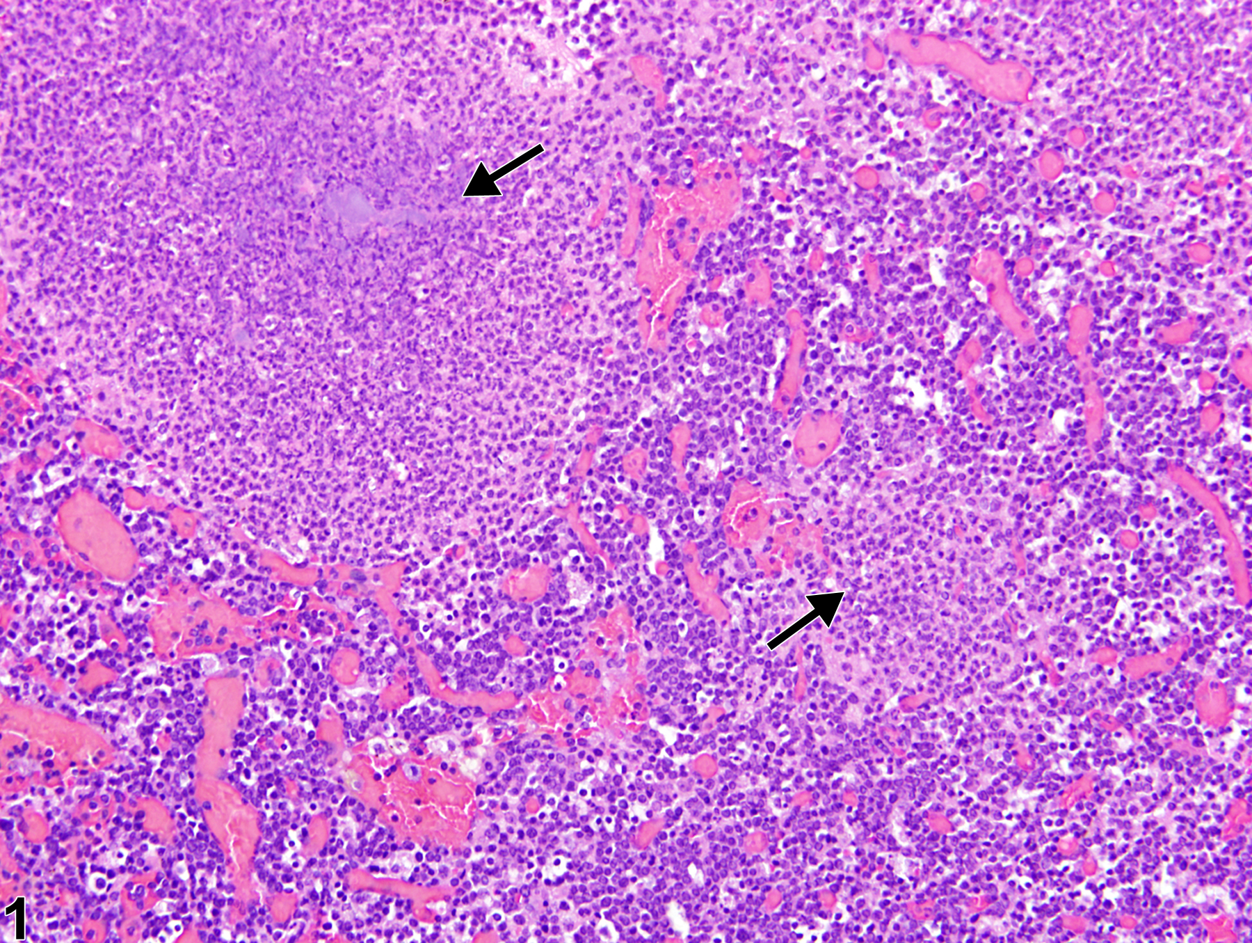 Image of inflammation in the thymus from a female B6C3F1/N mouse in a chronic study