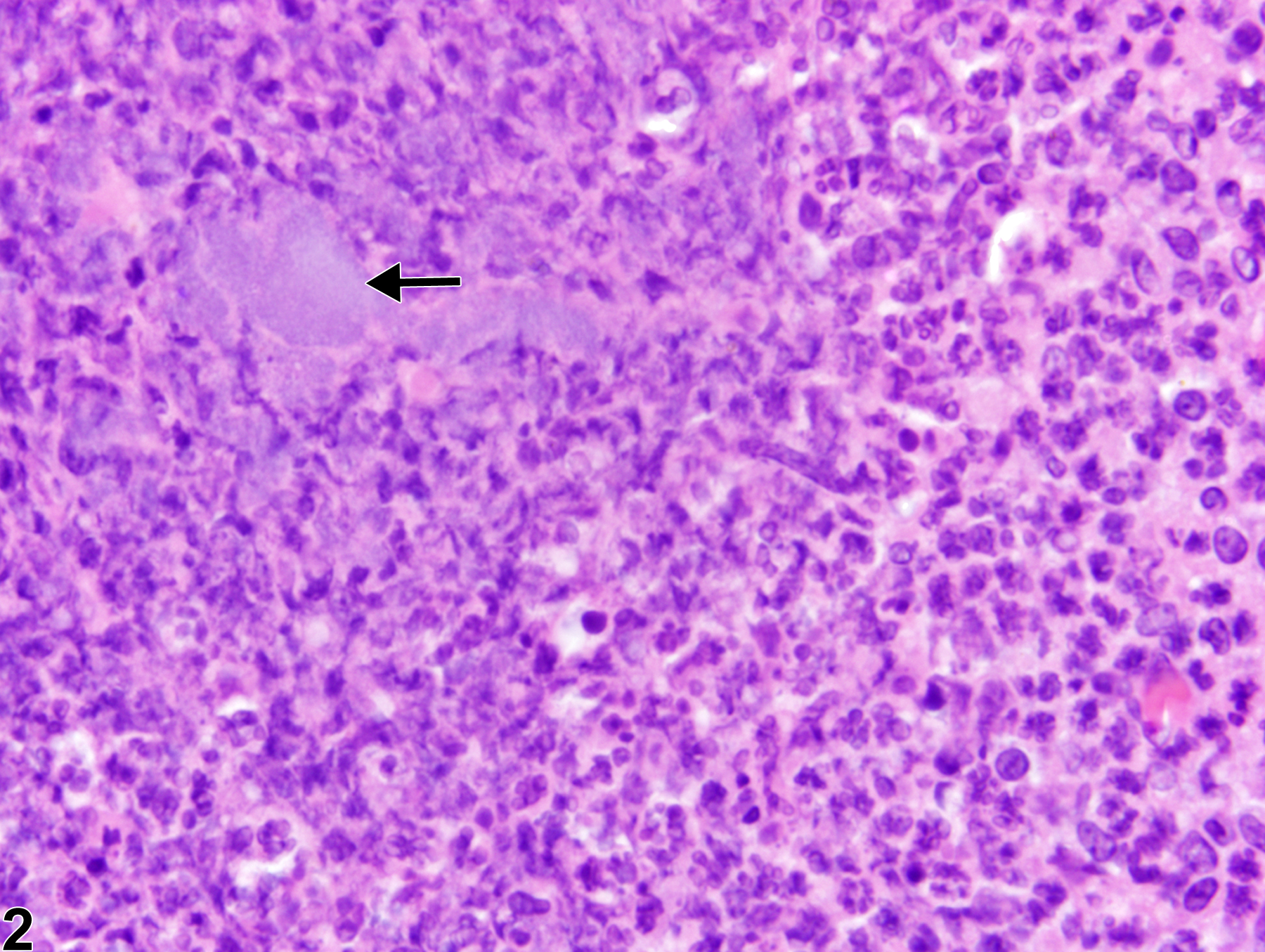 Image of inflammation in the thymus from a female B6C3F1/N mouse in a chronic study