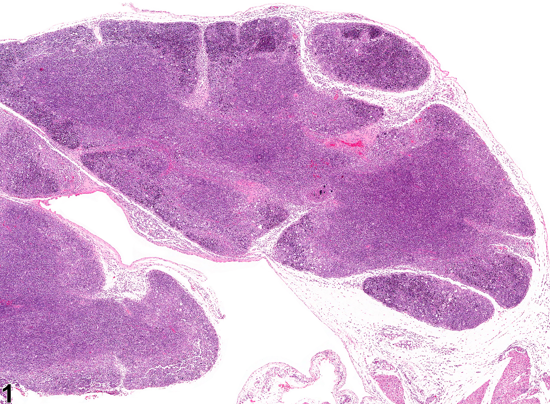 Image of necrosis, lymphocyte in the thymus from a male Harlan Sprague-Dawley rat in a chronic study