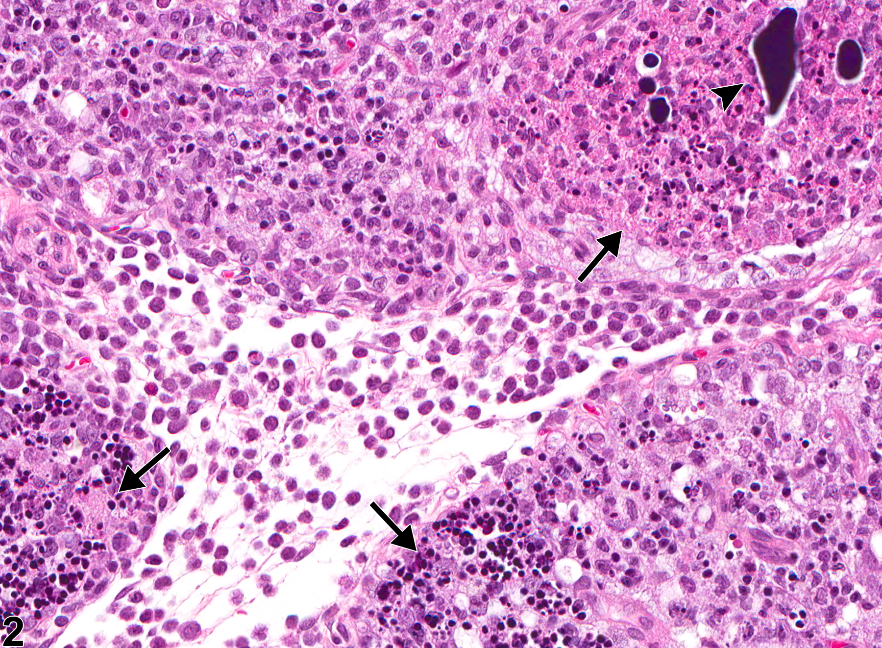 Image of necrosis, lymphocyte in the thymus from a male Harlan Sprague-Dawley rat in a chronic study