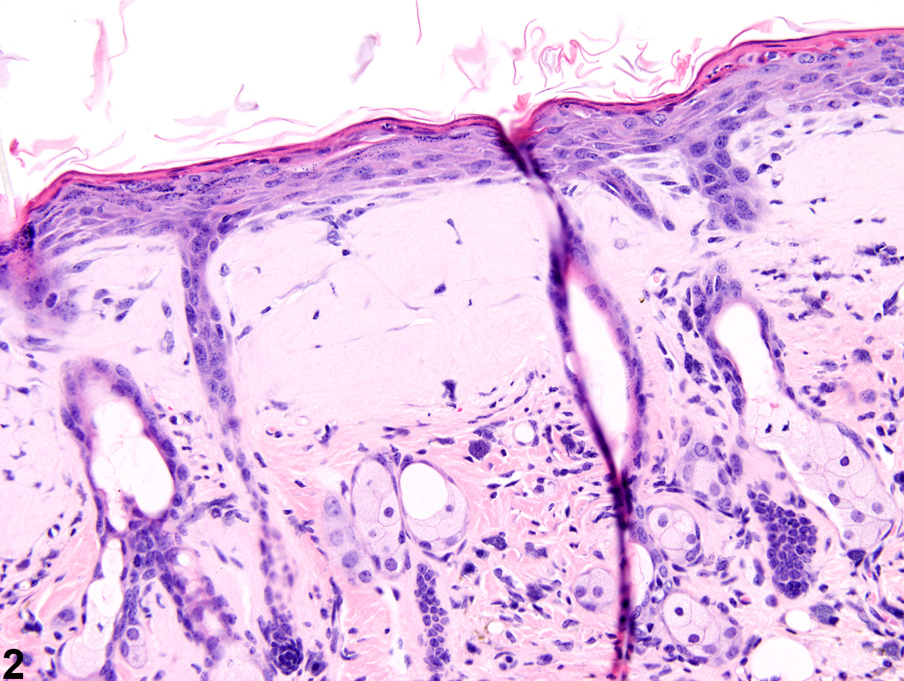 Image of amyloid in the skin from a female Swiss CD-1 mouse in a chronic study