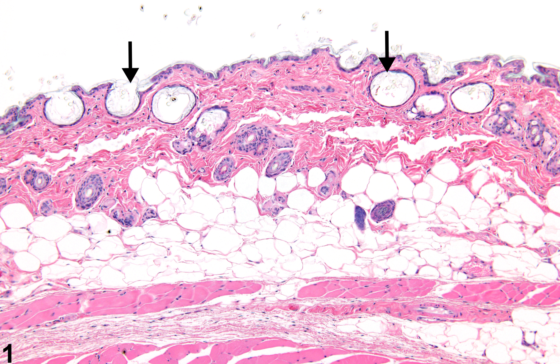 Image of dilatation in the skin follicle from a male B6C3F1 mouse in a chronic study