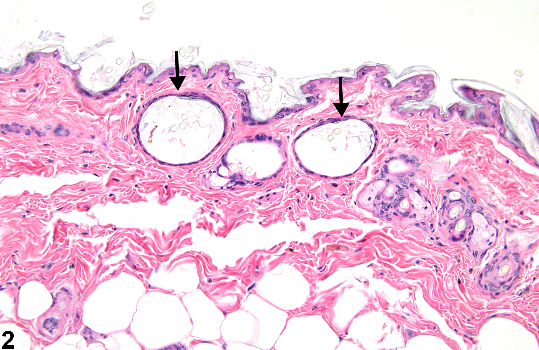 Image of dilatation in the skin follicle from a male B6C3F1 mouse in a chronic study