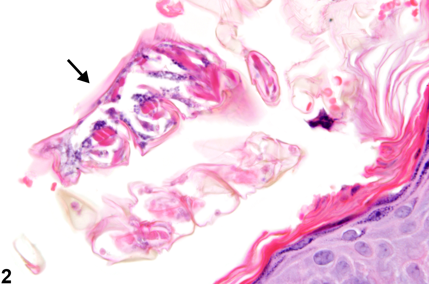 Image of ectoparasites in the skin from a female B6C3F1 mouse in a chronic study