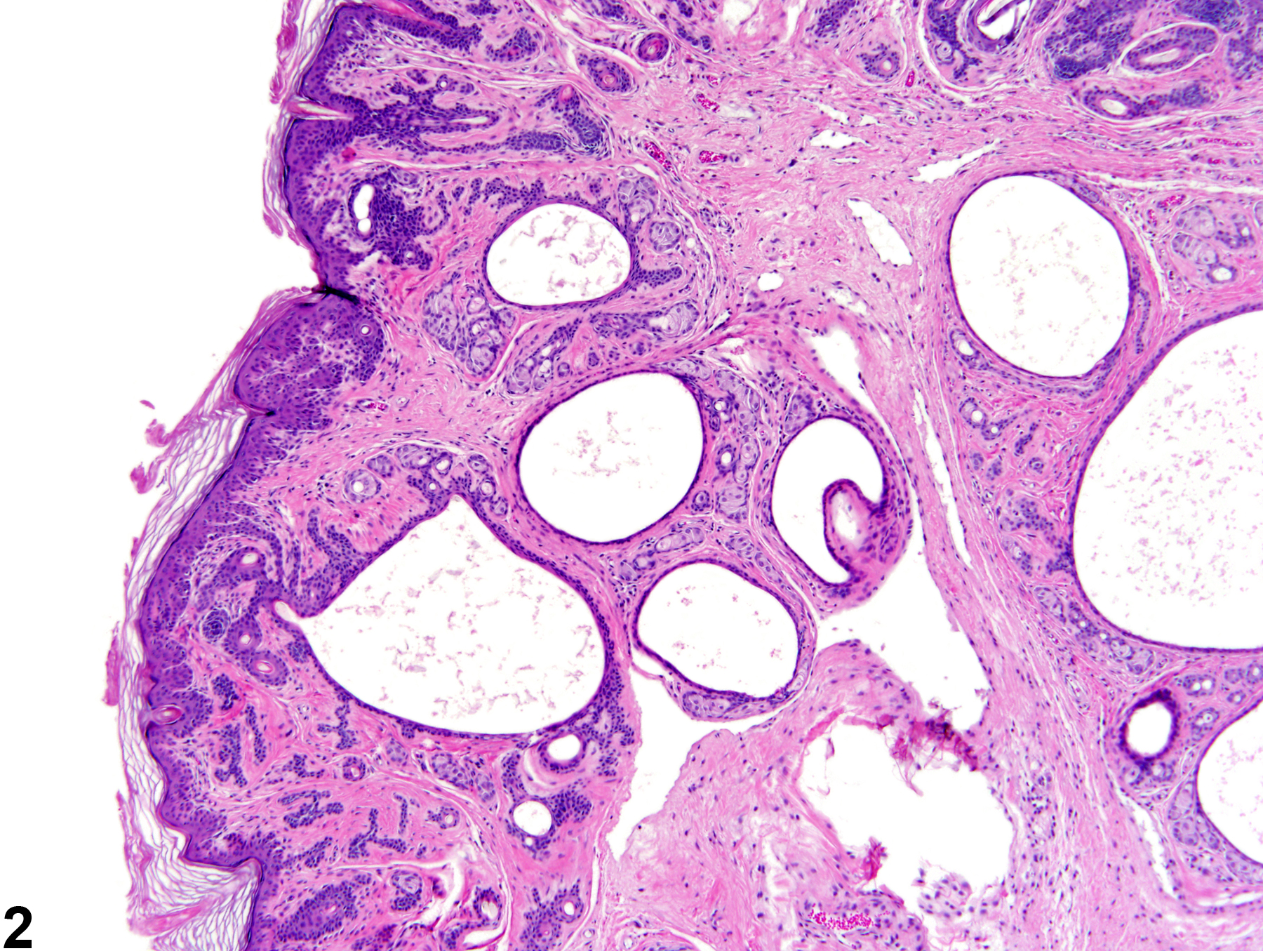 Image of fibroadnexal hamartoma in the skin from a female F344/N rat in a chronic study