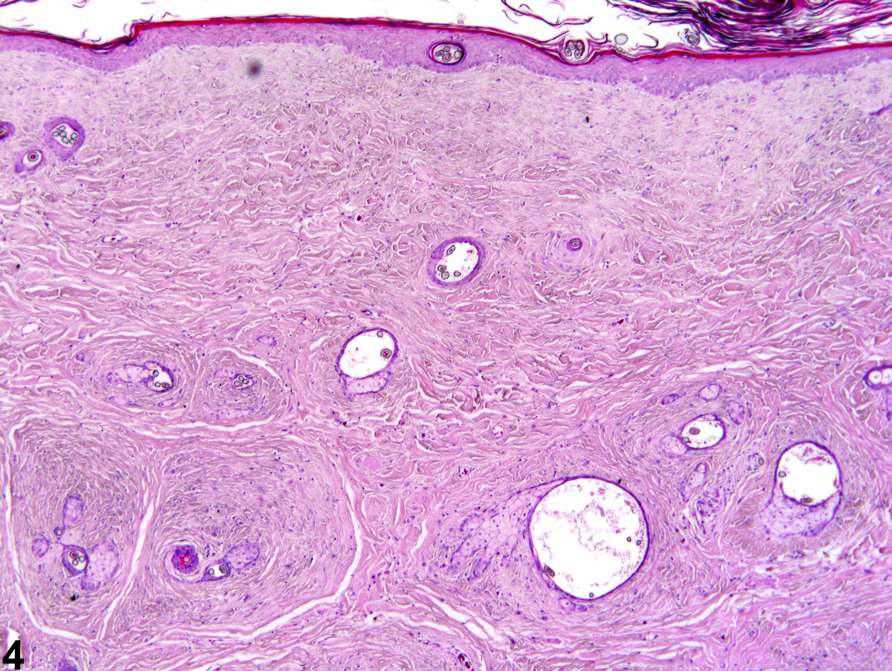 Image of fibroadnexal hamartoma in the skin from a male F344/N rat in a chronic study