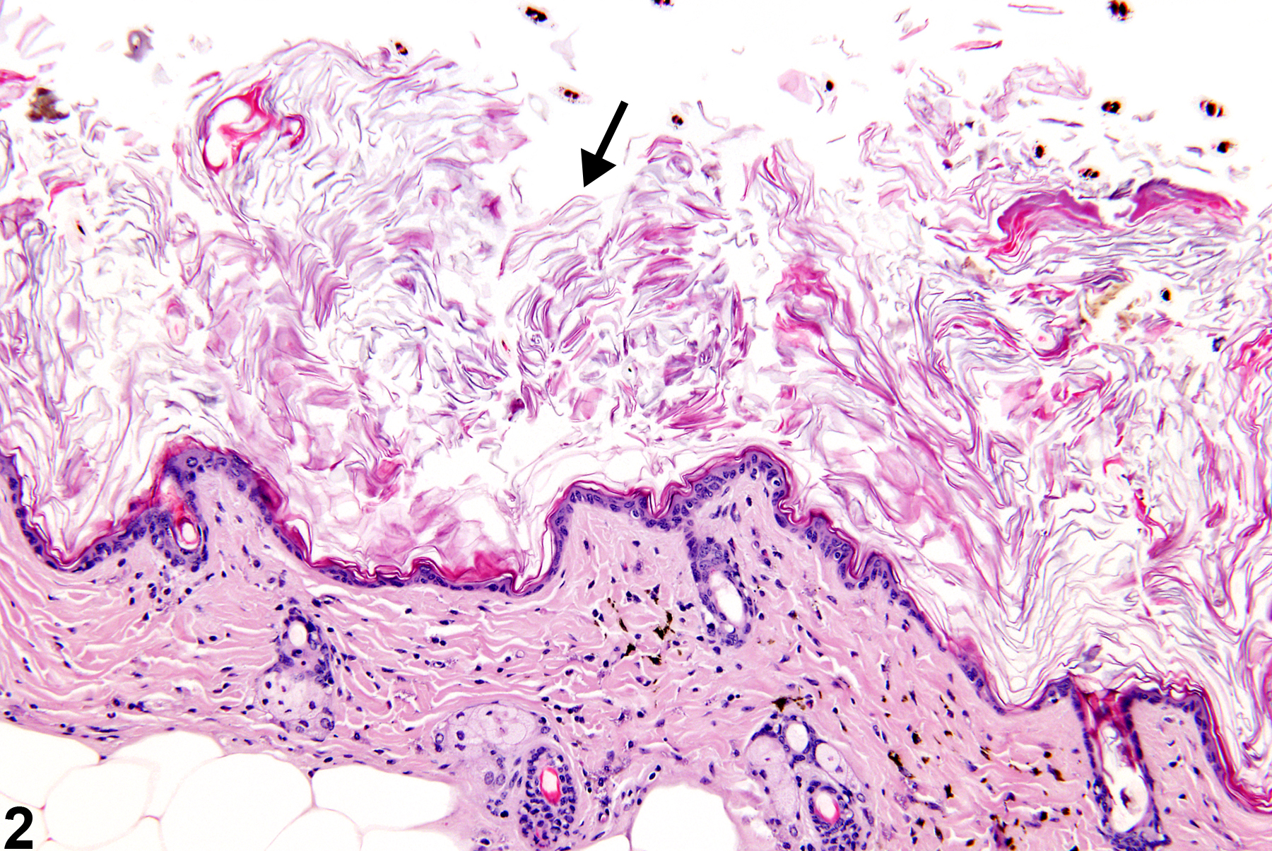 Image of hyperkeratosis in the skin from a female B6C3F1 mouse in a chronic study