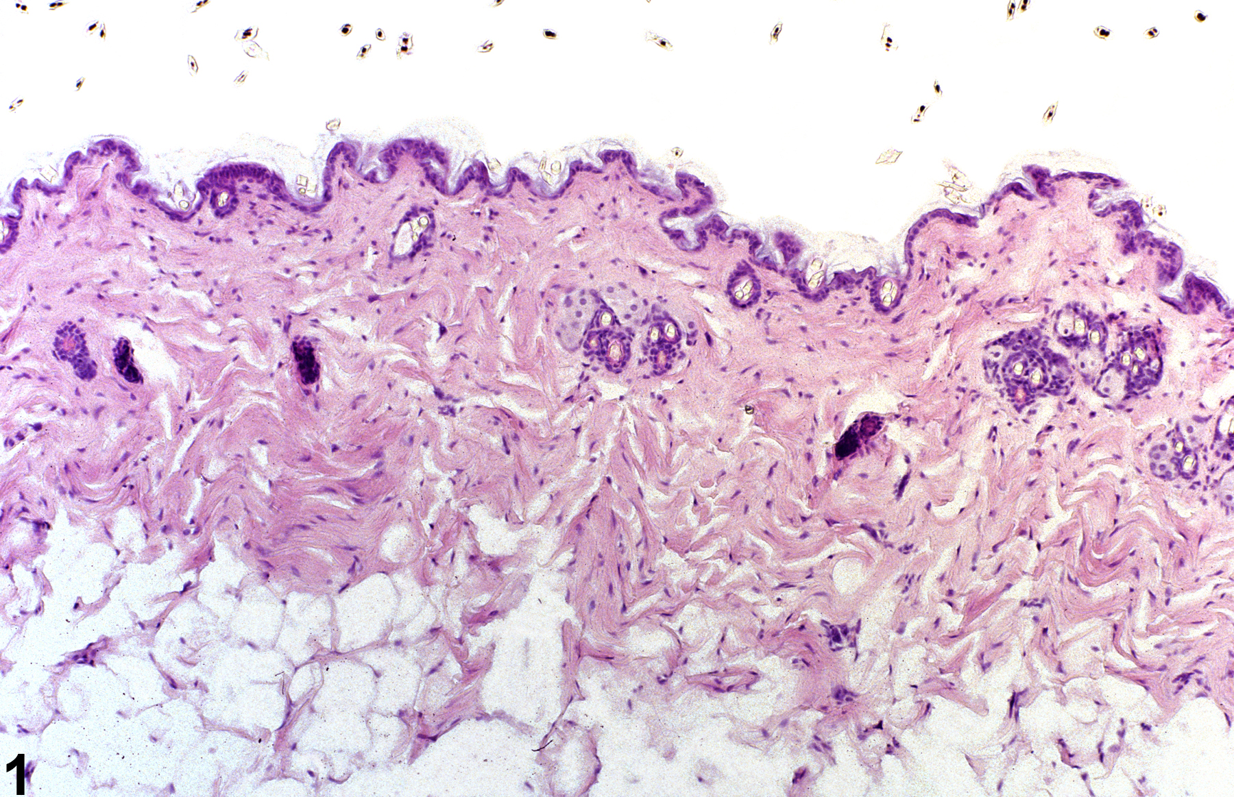 Image of Hyperplasia (normal comparison) in the Skin from a Male B6C3F1 Mouse in a 90-day  Study
