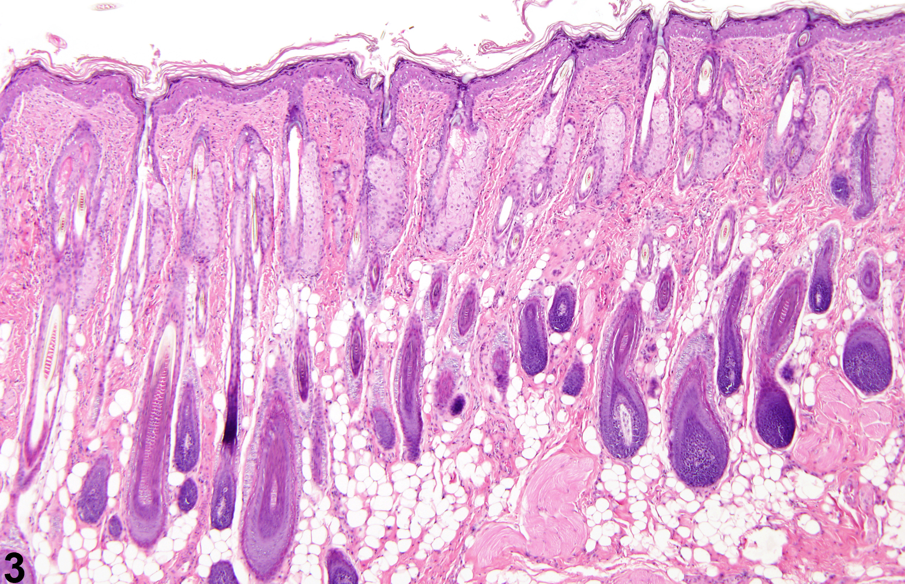 Image of Hyperplasia in the Skin from a Male F344/N Rat in a 90-day  Study