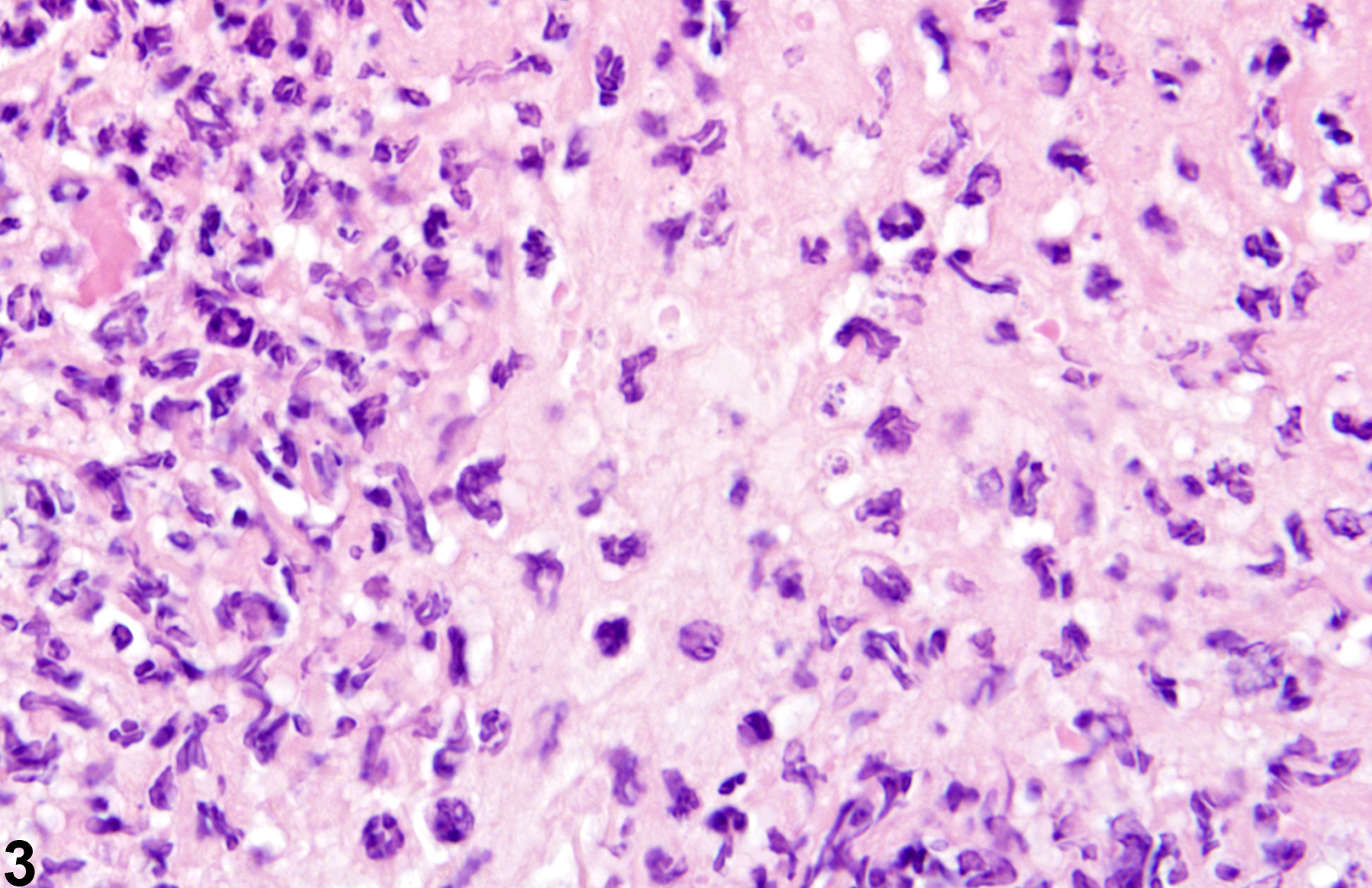 Image of inflammation in the skin from a male B6C3F1 mouse in a chronic study