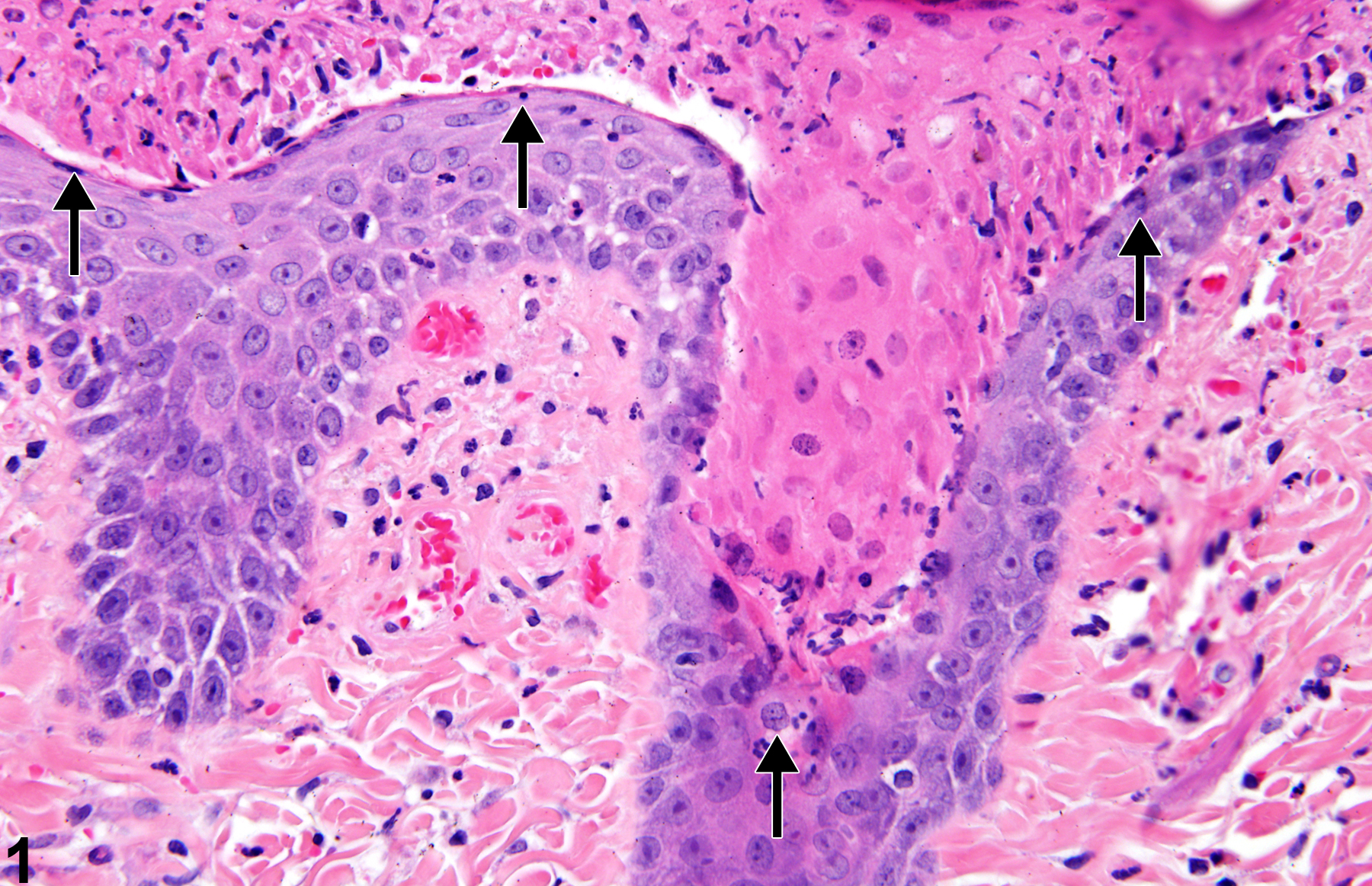 Image of Necrosis in the Skin from a Male F344/N Rat in a 90-day  Study