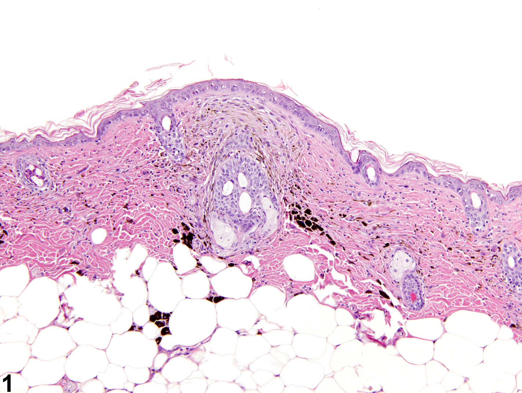 Image of pigment in the skin from a male B6C3F1 mouse in a chronic study