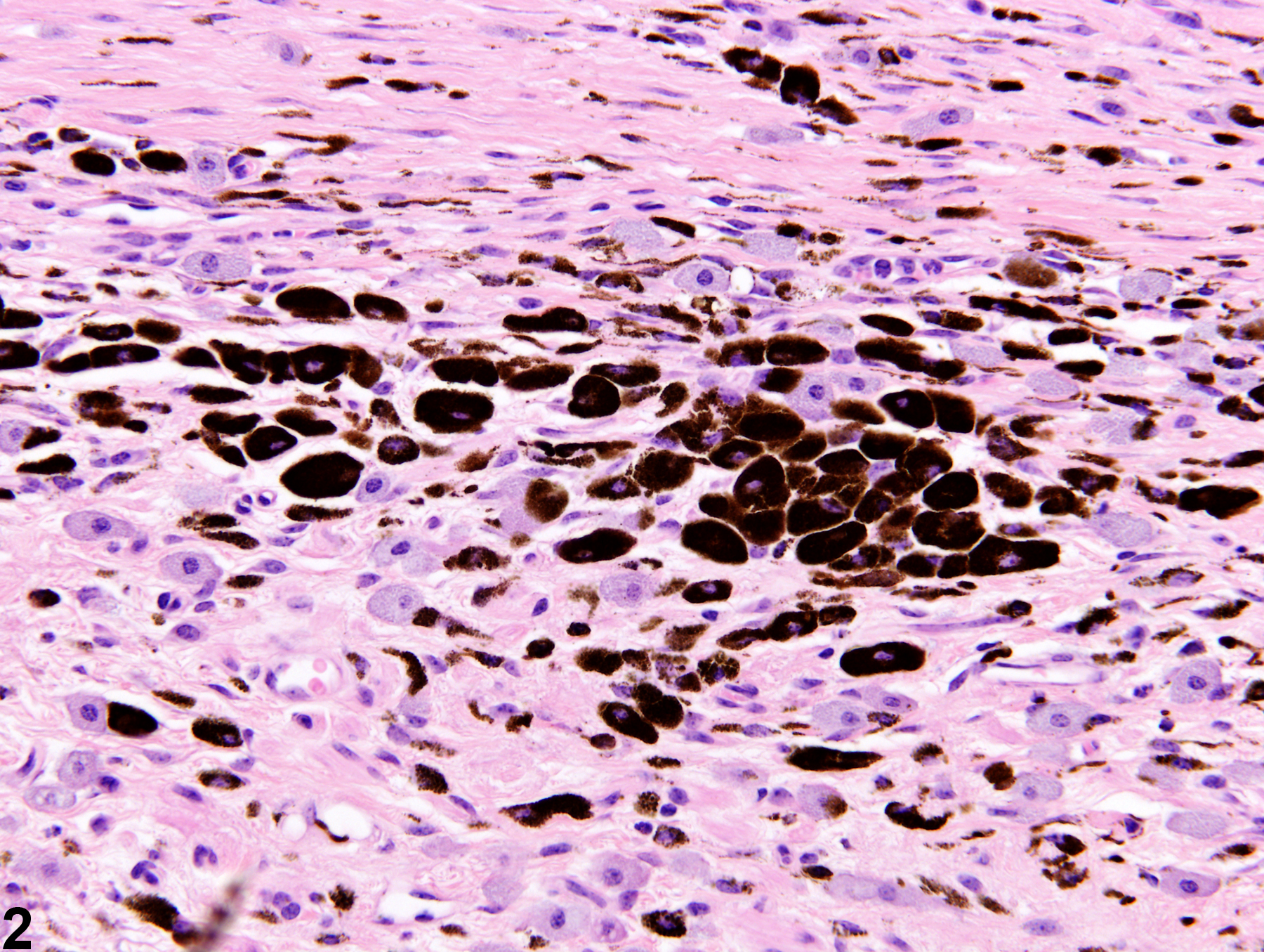 Image of pigment in the skin from a male B6C3F1 mouse in a chronic study