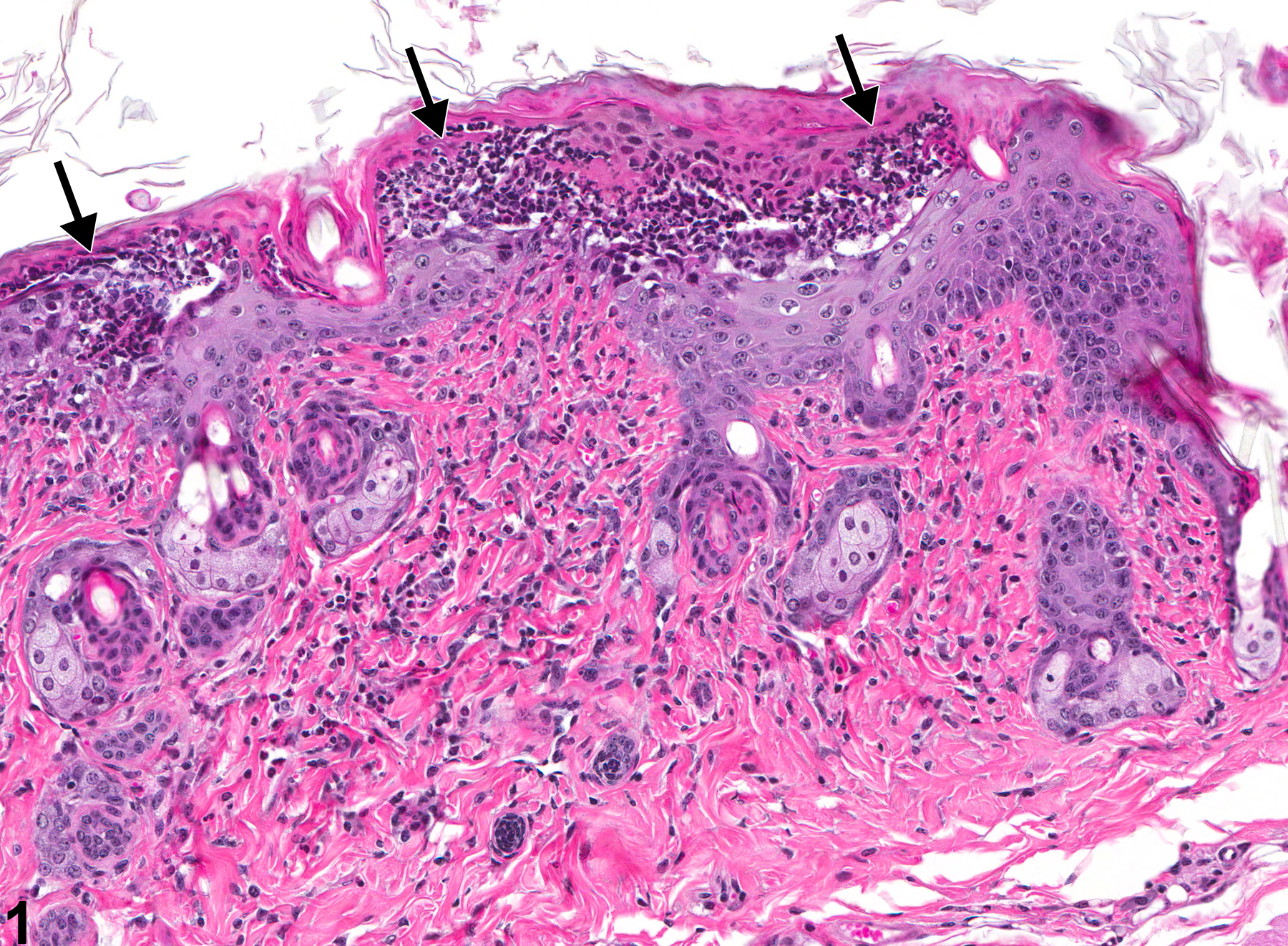 Image of pustule in the skin from a male B6C3F1 mouse in a subchronic study