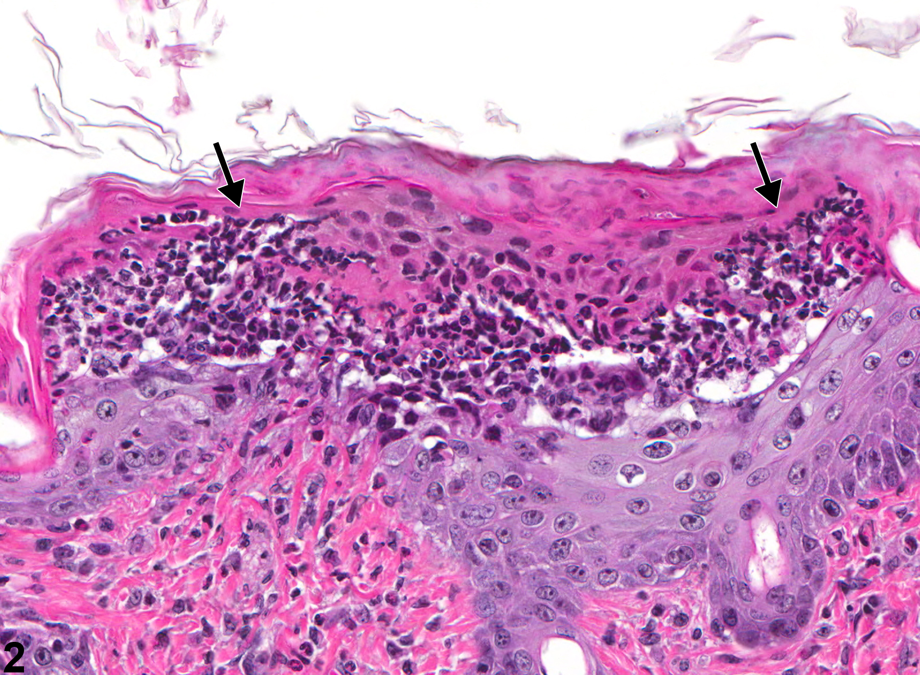 Image of pustule in the skin from a male B6C3F1 mouse in a subchronic study