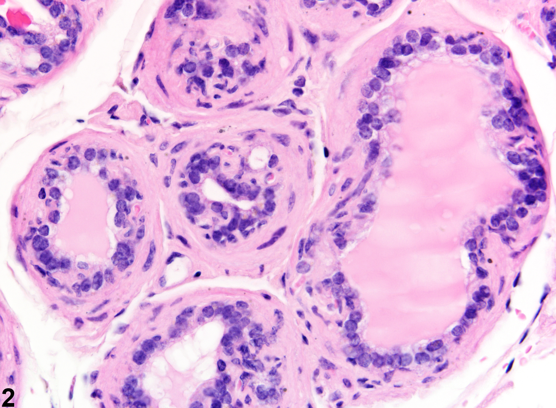 Image of atrophy in the coagulating gland from a male B6C3F1 mouse in a chronic study