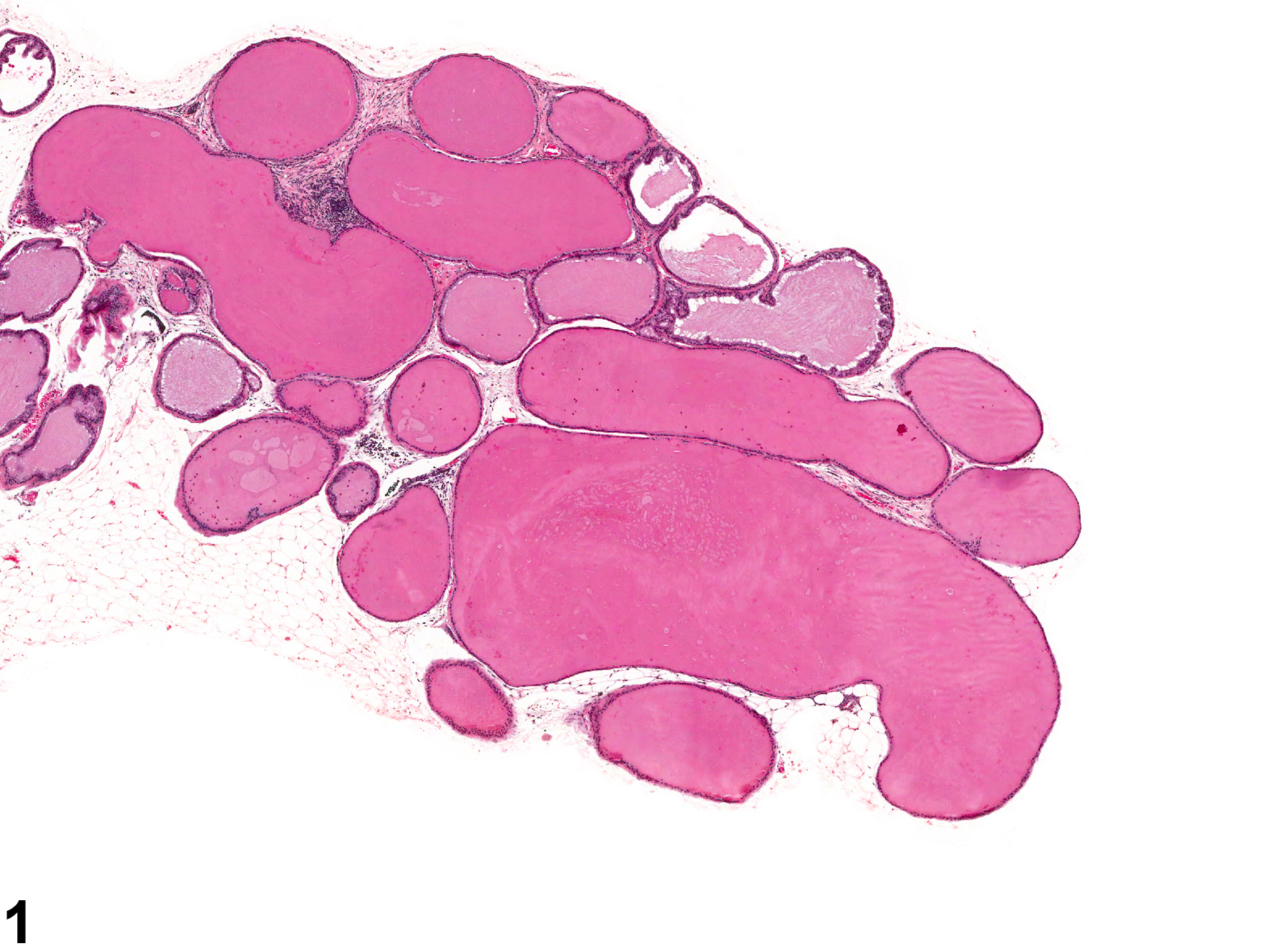 Image of dilation, acinar in the coagulating gland from a male B6C3F1 mouse in a chronic study