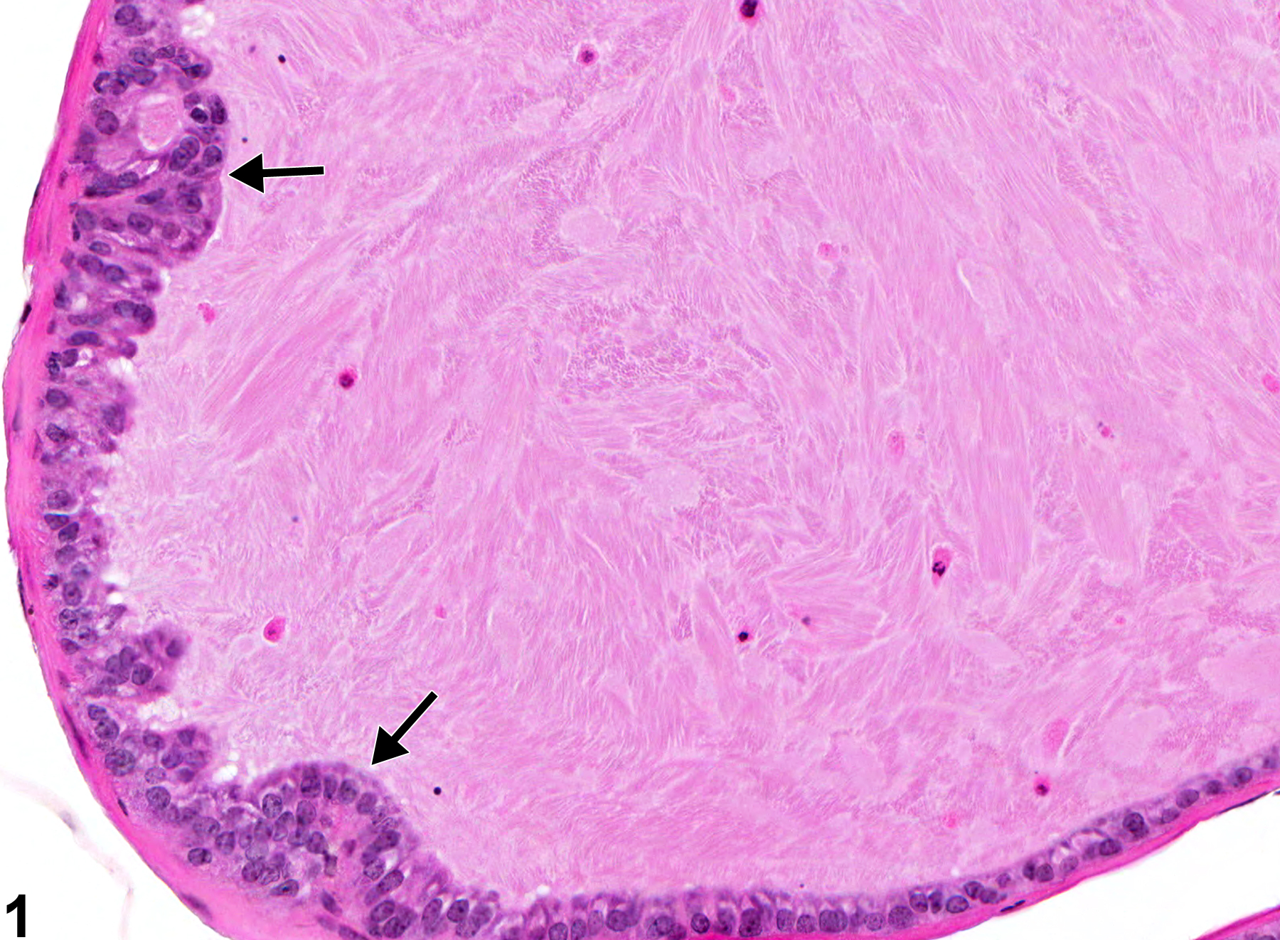 Image of hyperplasia in the coagulating gland from a male B6C3F1 mouse in a chronic study