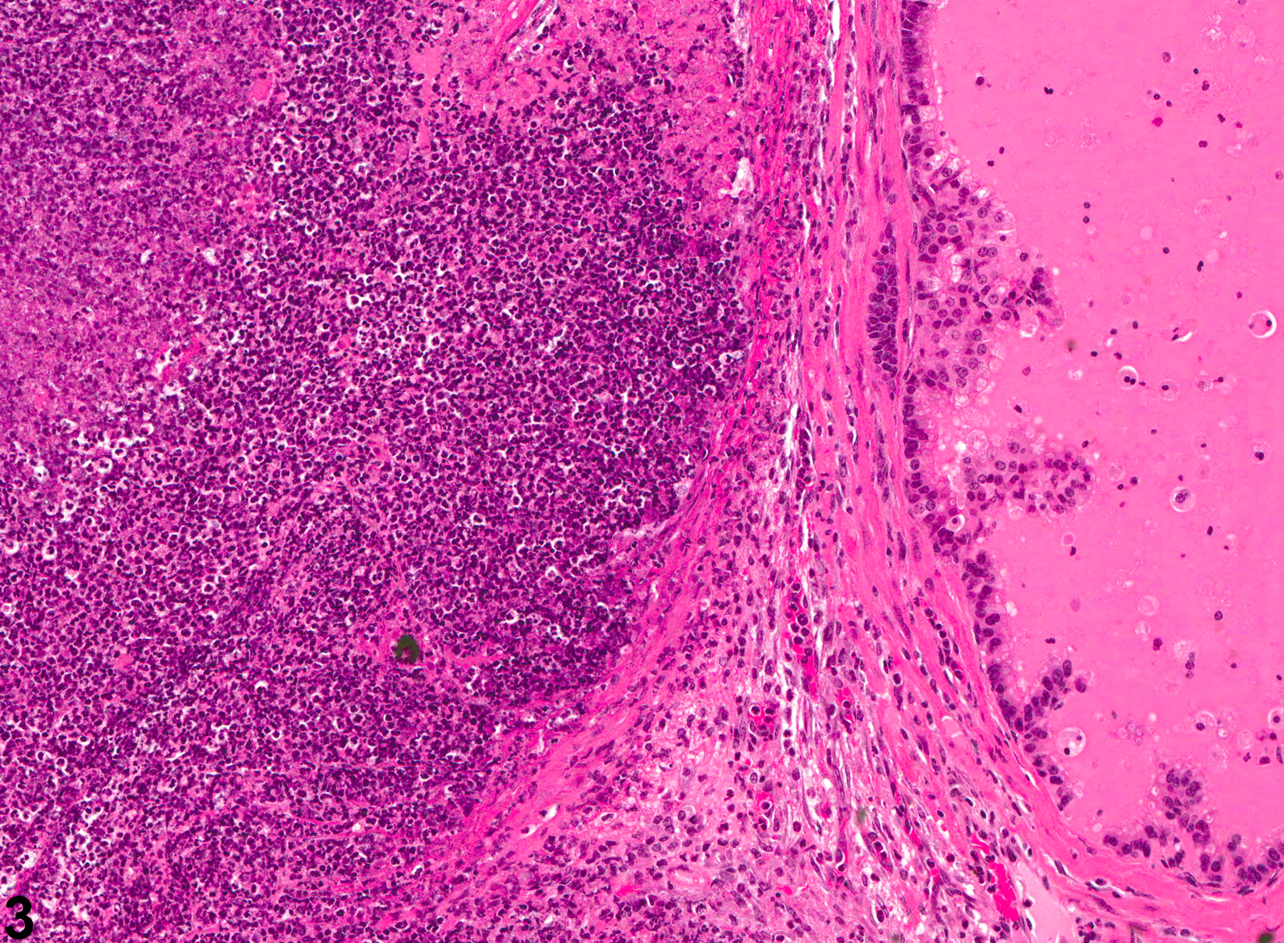 Image of inflammation in the coagulating gland from a male Swiss CD-1 mouse in a chronic study