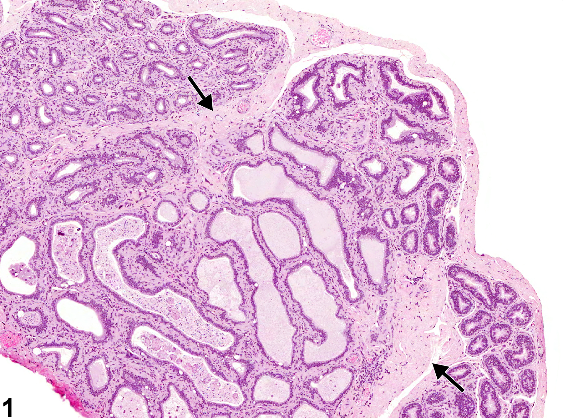 Image of amyloid in the epididymis from a male B6C3F1 mouse in a chronic study