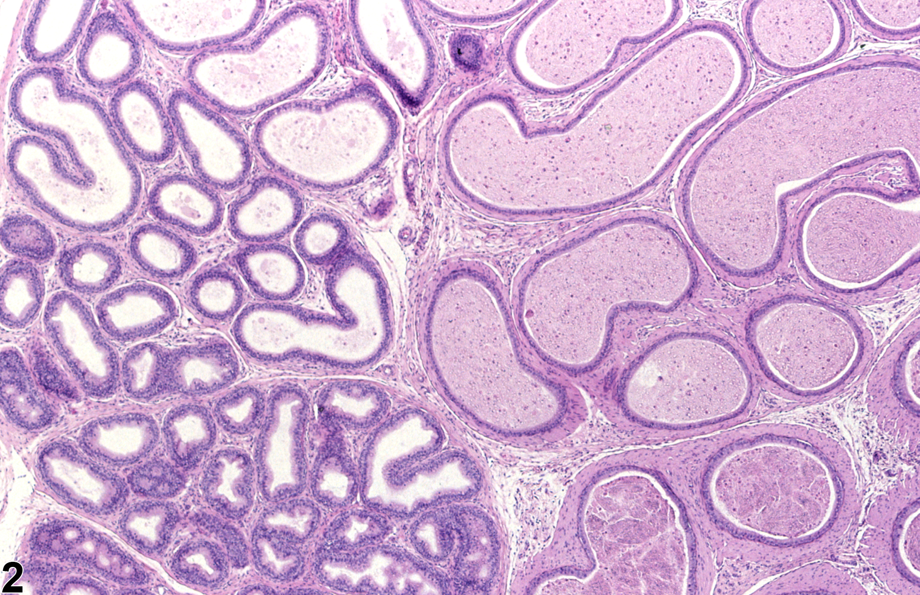 Image of duct atrophy in the epididymis from a male F344/N rat in a subchronic study