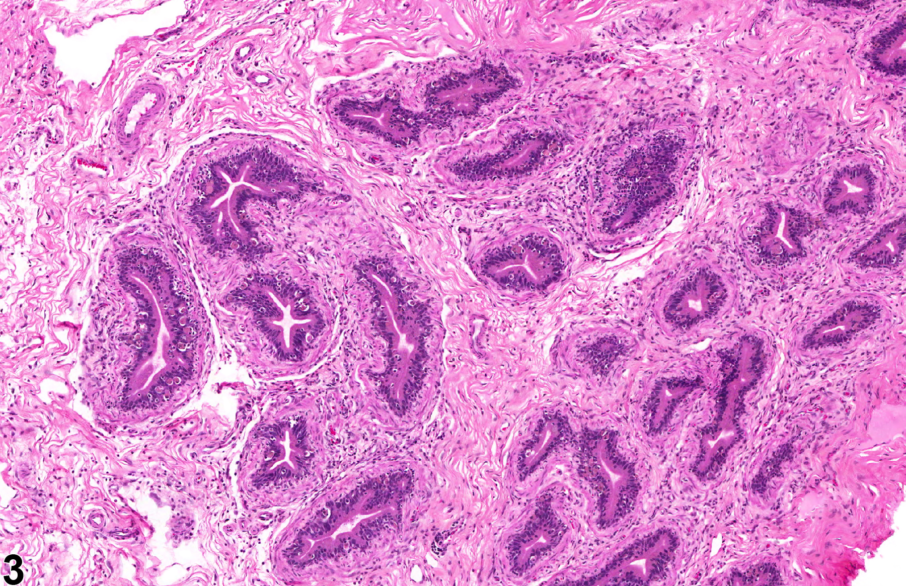 Image of duct atrophy in the epididymis from a male F344/N rat in a chronic study