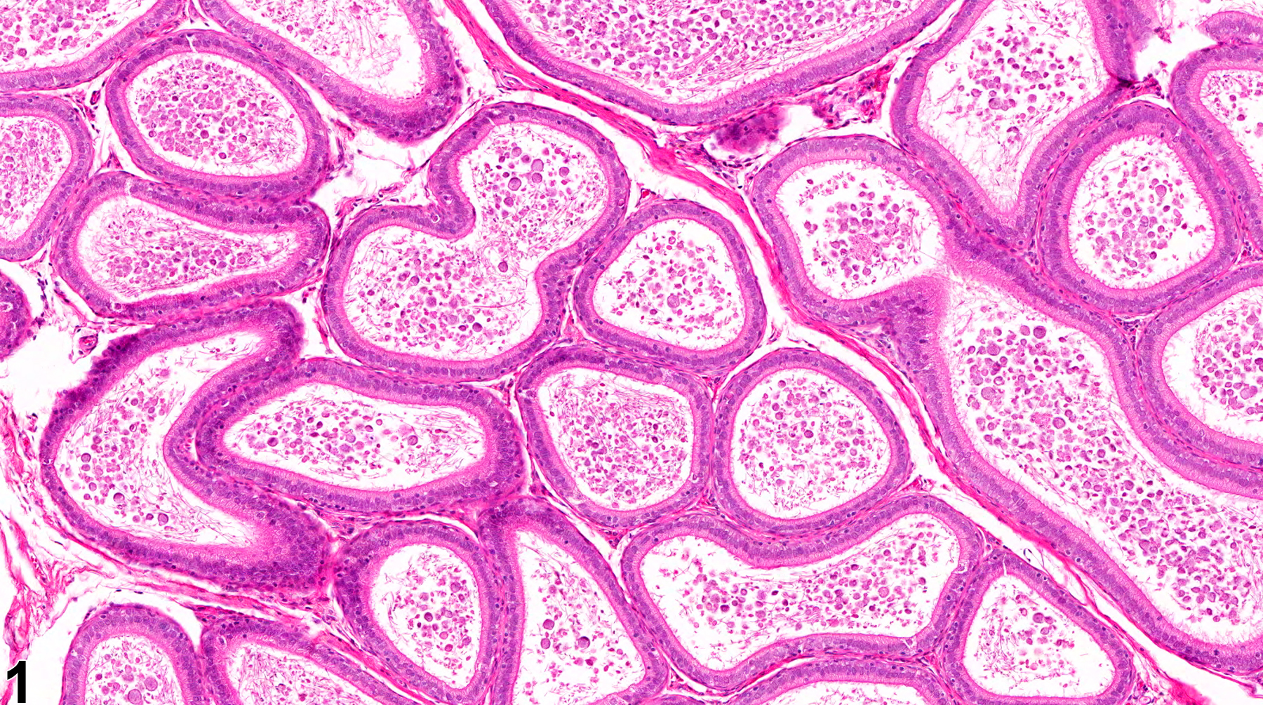 Image of duct exfoliated germ cell in the epididymis from a male F344/N rat in a subchronic study