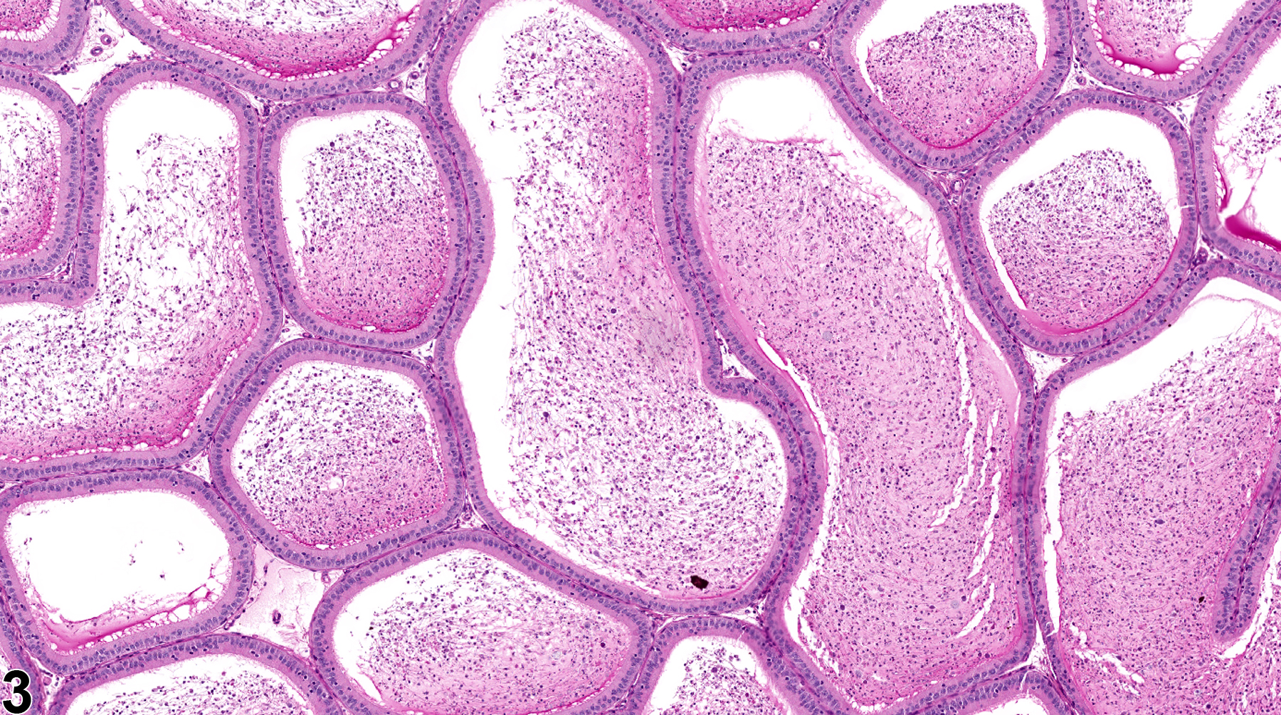 Image of duct exfoliated germ cell in the epididymis from a  rat