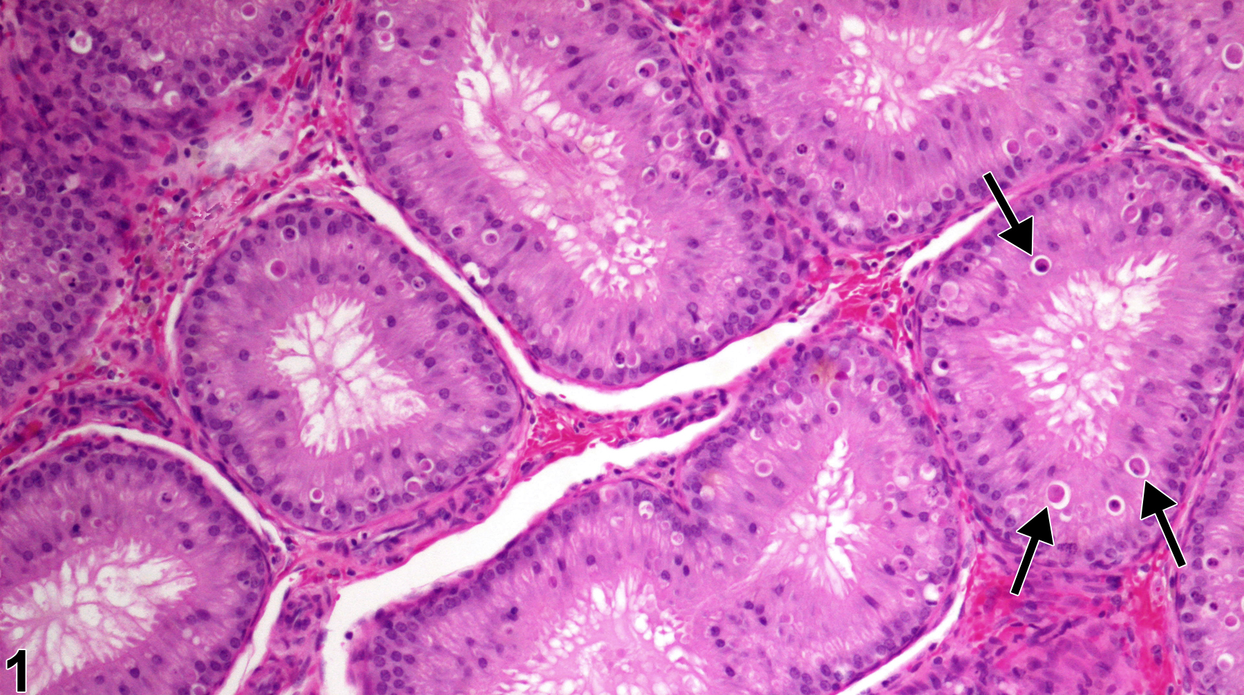 Image of epithelial apoptosis in the epididymis from a  rat