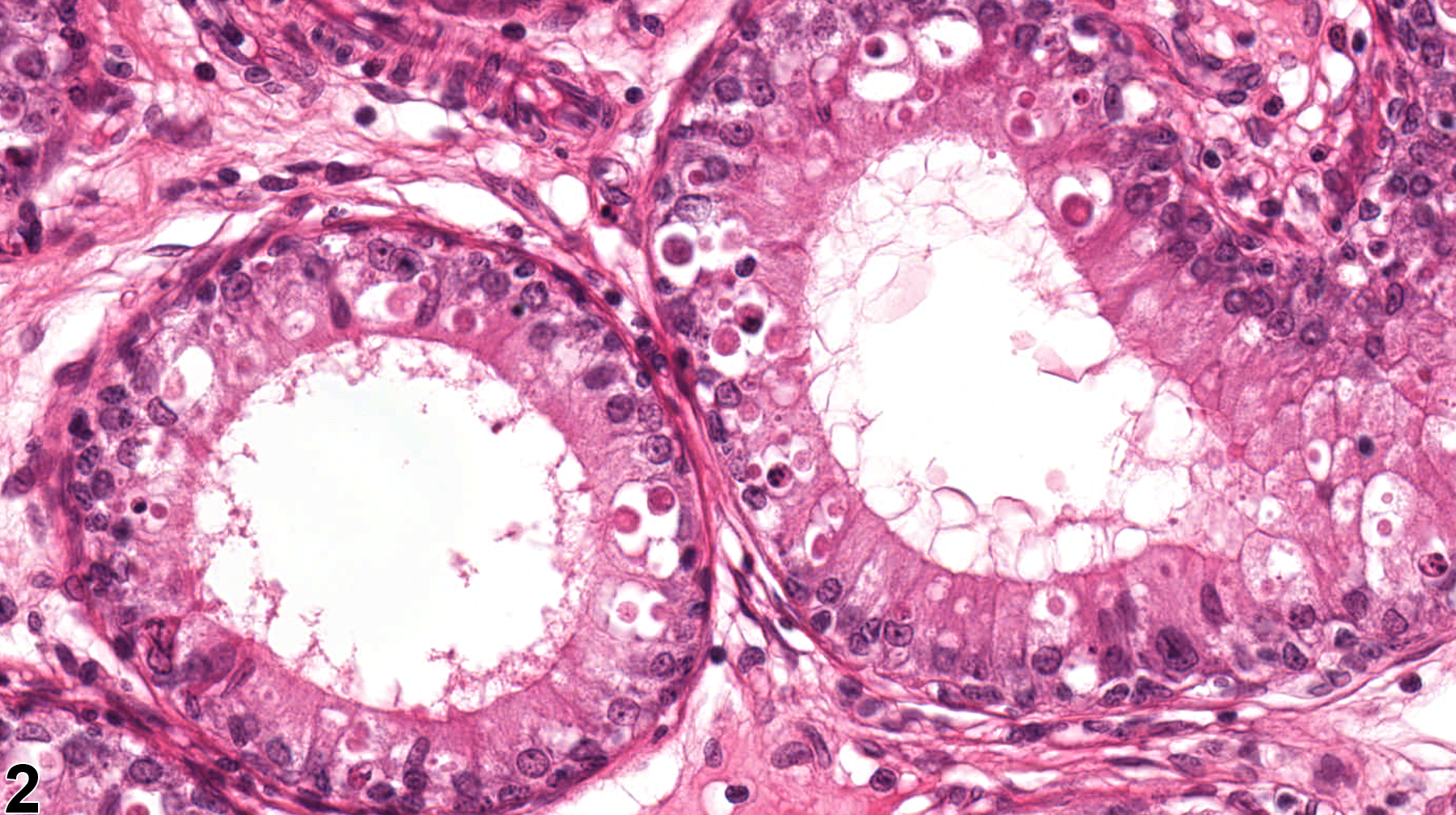 Image of epithelial apoptosis in the epididymis from a  rat