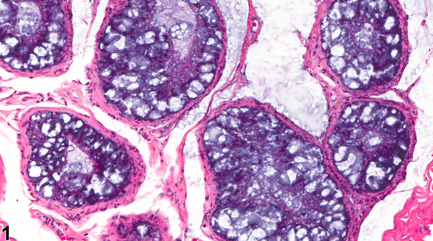 Image of epithelial vacuolation in the epididymis from a male F344/N rat in a chronic study