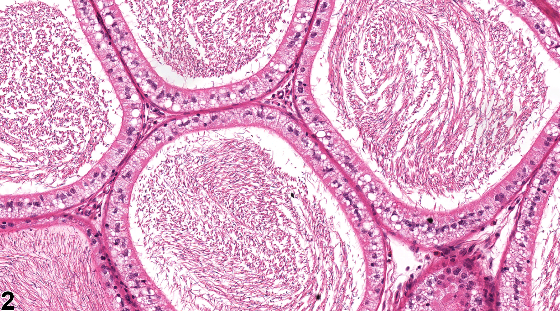 Image of epithelial vacuolation in the epididymis from a  rat