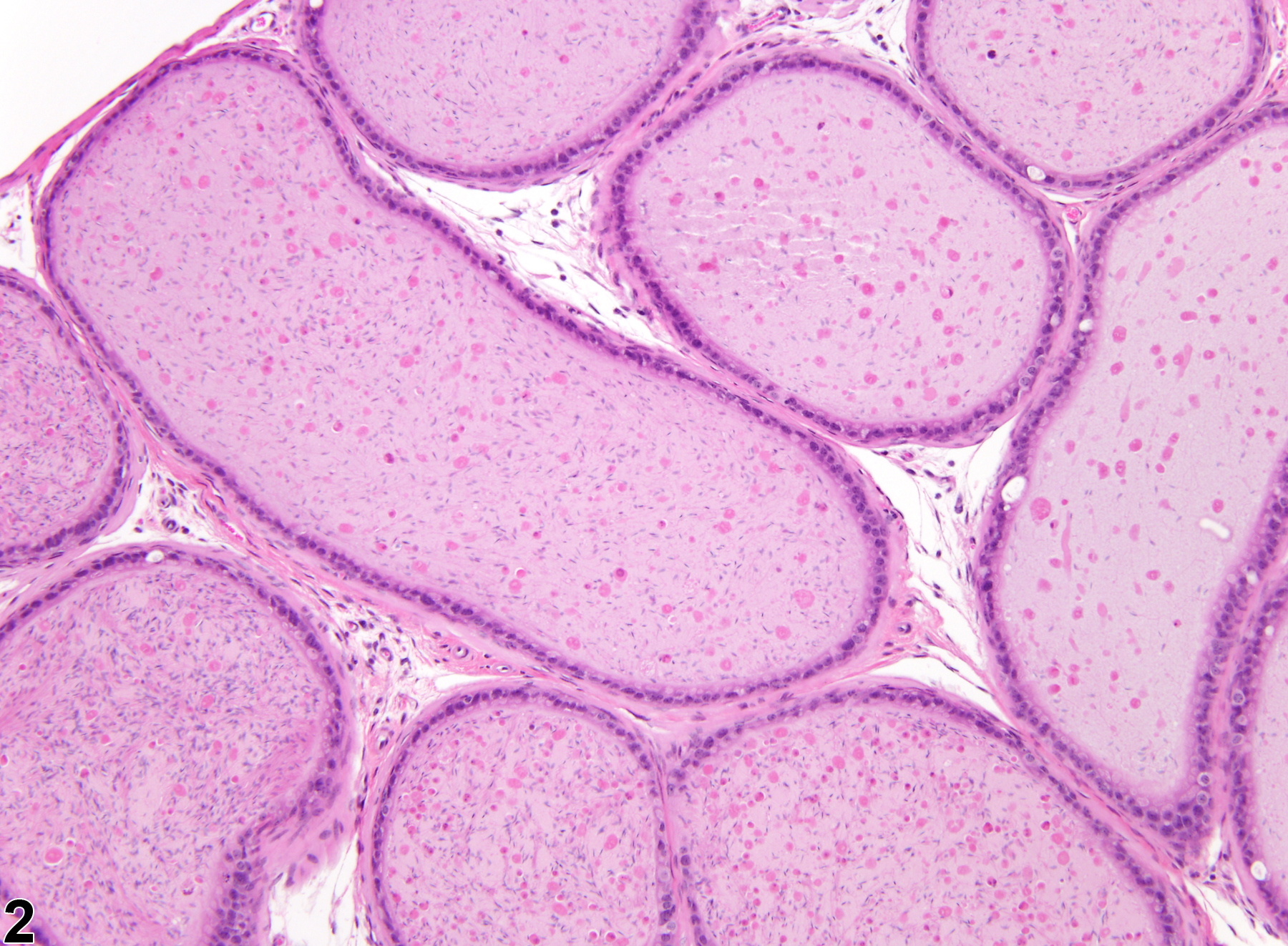 Image of hypospermia in the epididymis from a male B6C3F1 mouse in a subchronic study
