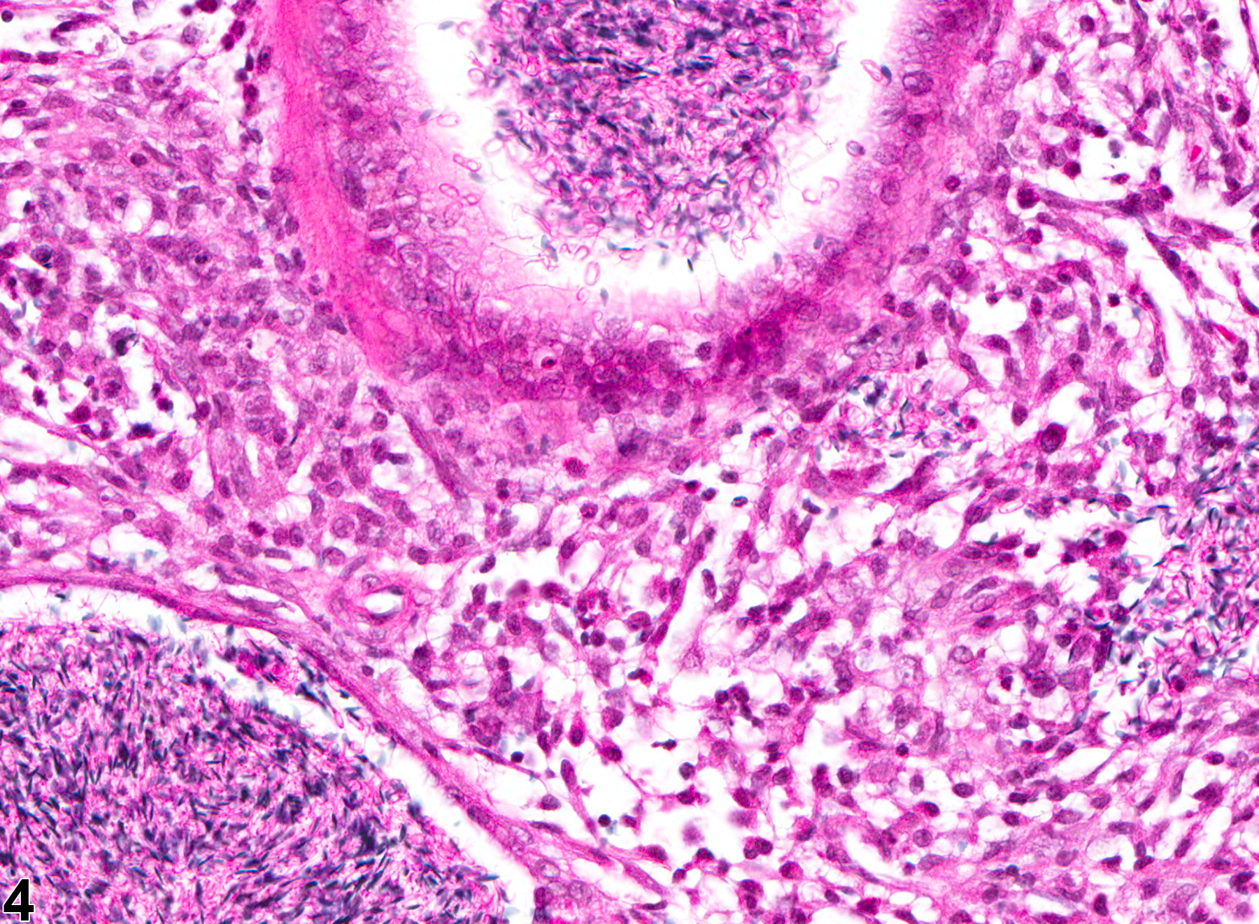 Image of inflammation in the epididymis from a male B6C3F1 mouse in a chronic study