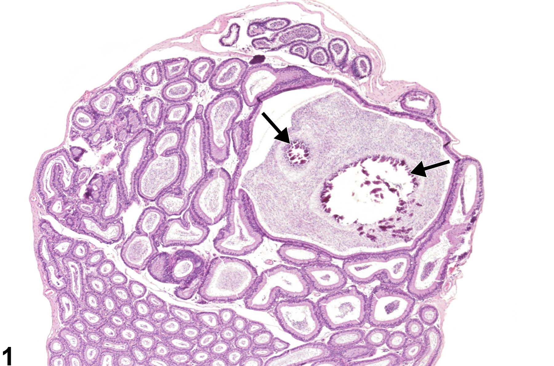 Image of spermatocele in the epididymis from a male B6C3F1 mouse in a subchronic study