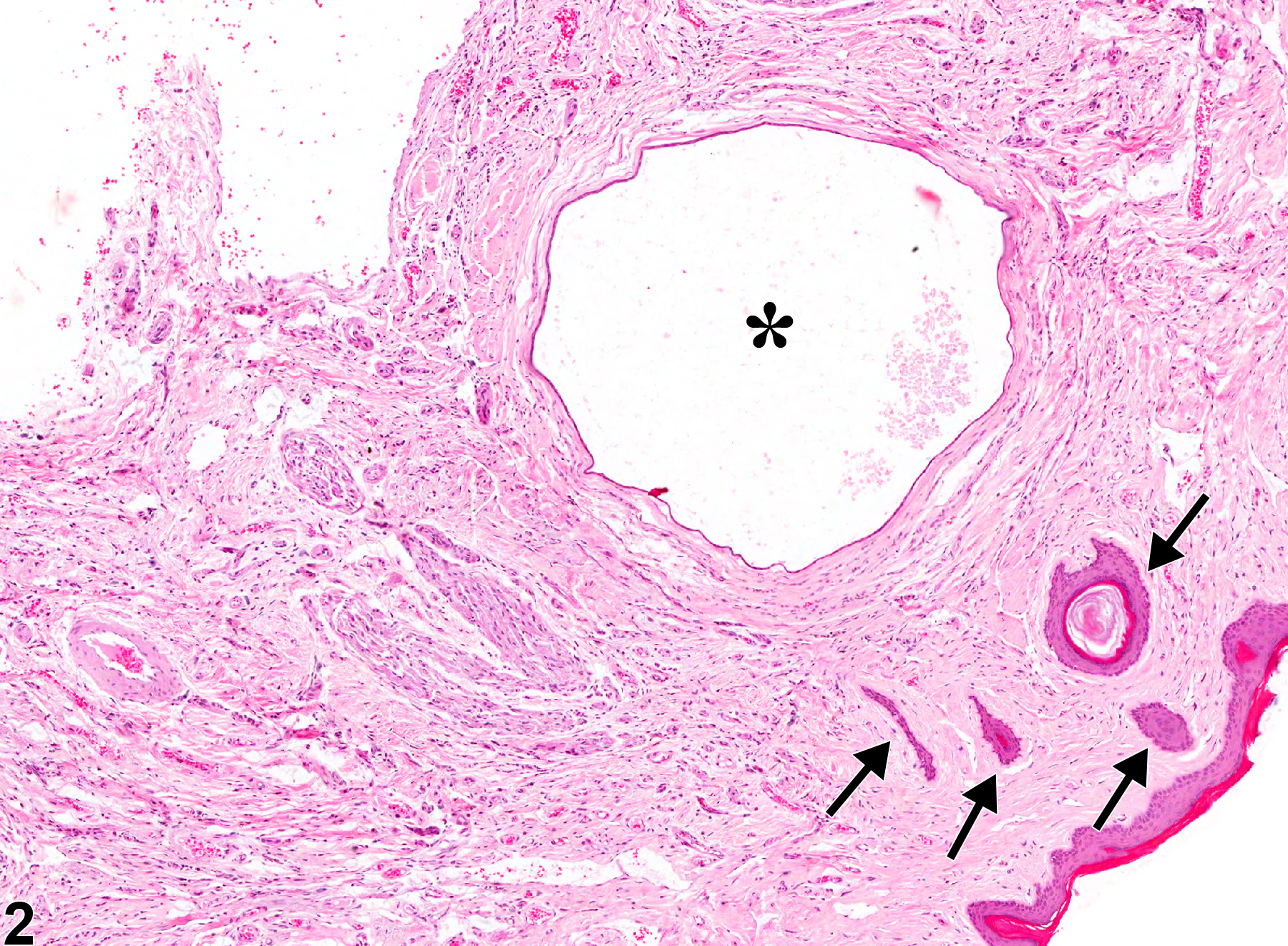 Image of fibrosis in the penis from a male B6C3F1 mouse in a chronic study