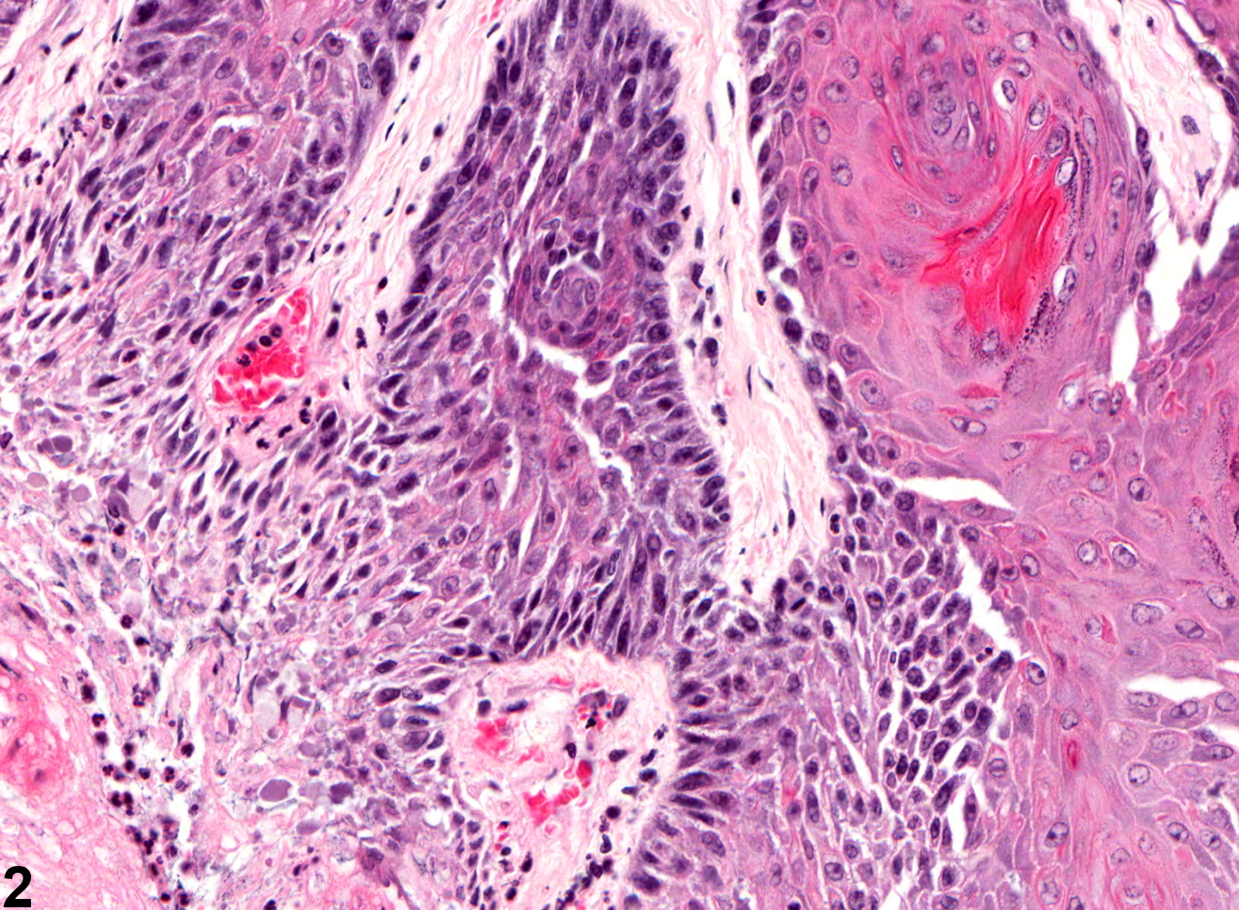 Image of epithelial hyperplasia in the penis from a male B6C3F1 mouse in a chronic study