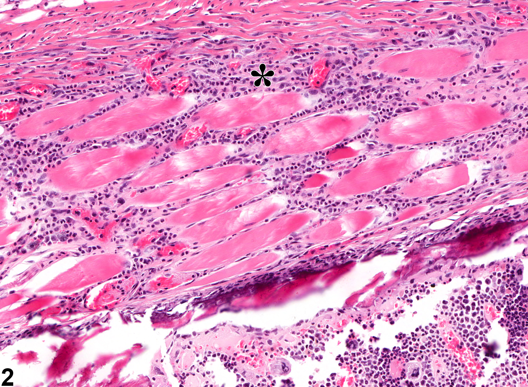 Image of inflammation in the penis from a male B6C3F1 mouse in a chronic study